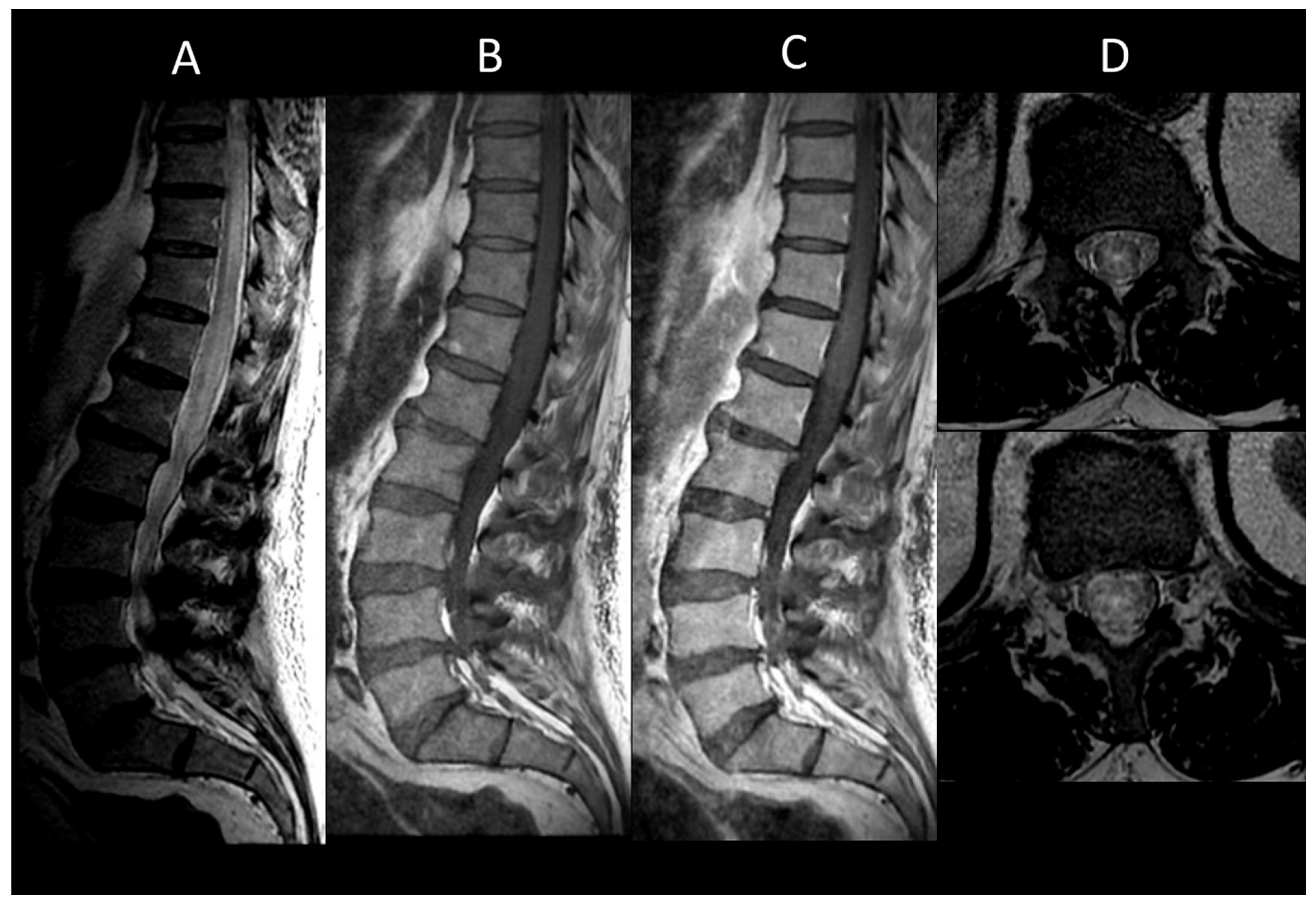 Cancers 16 01004 g003