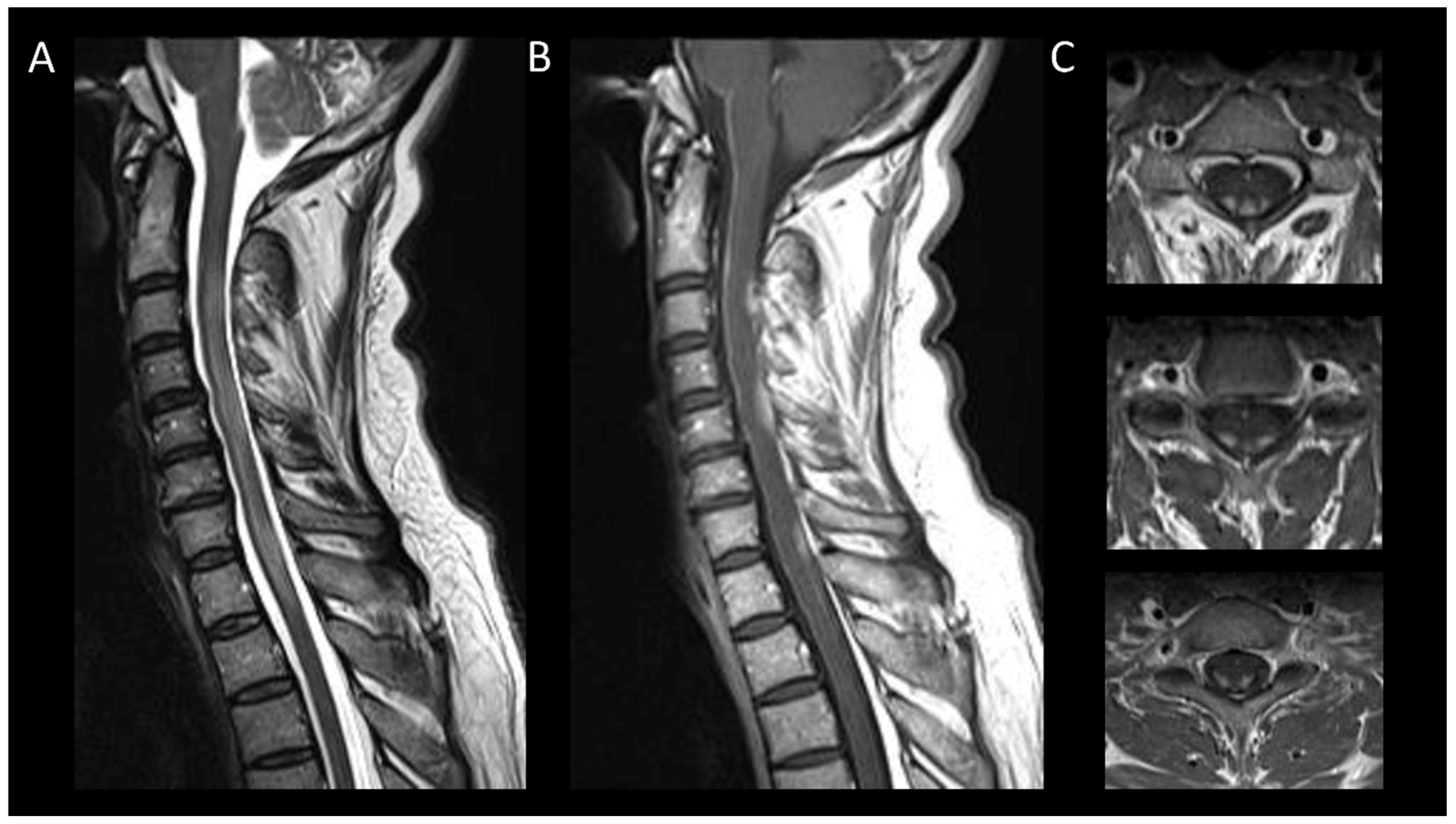 Cancers 16 01004 g004