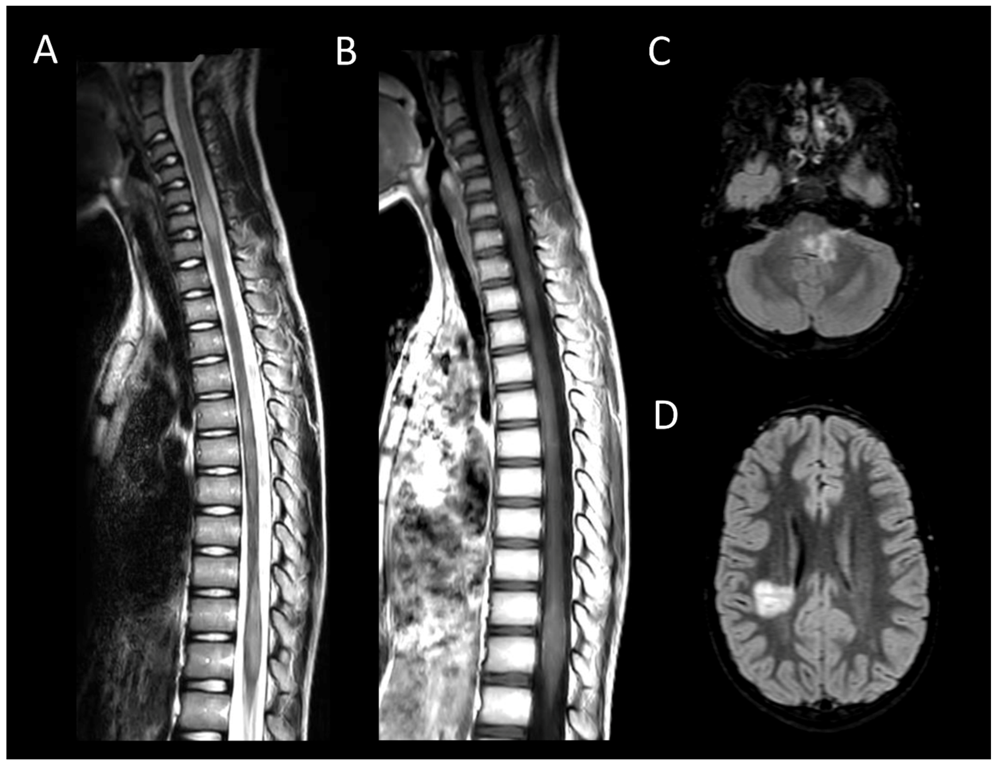 Cancers 16 01004 g005