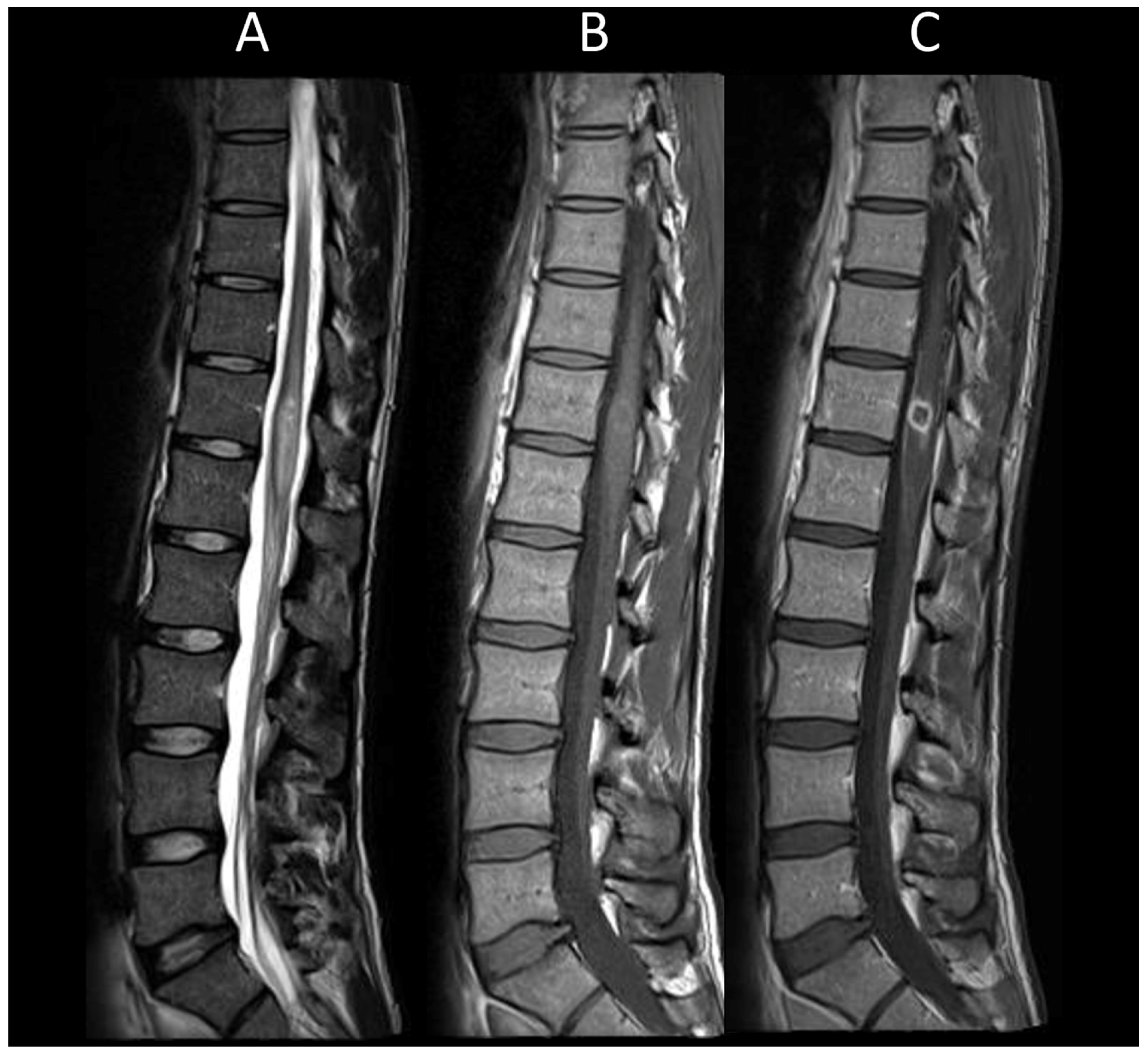 Cancers 16 01004 g006
