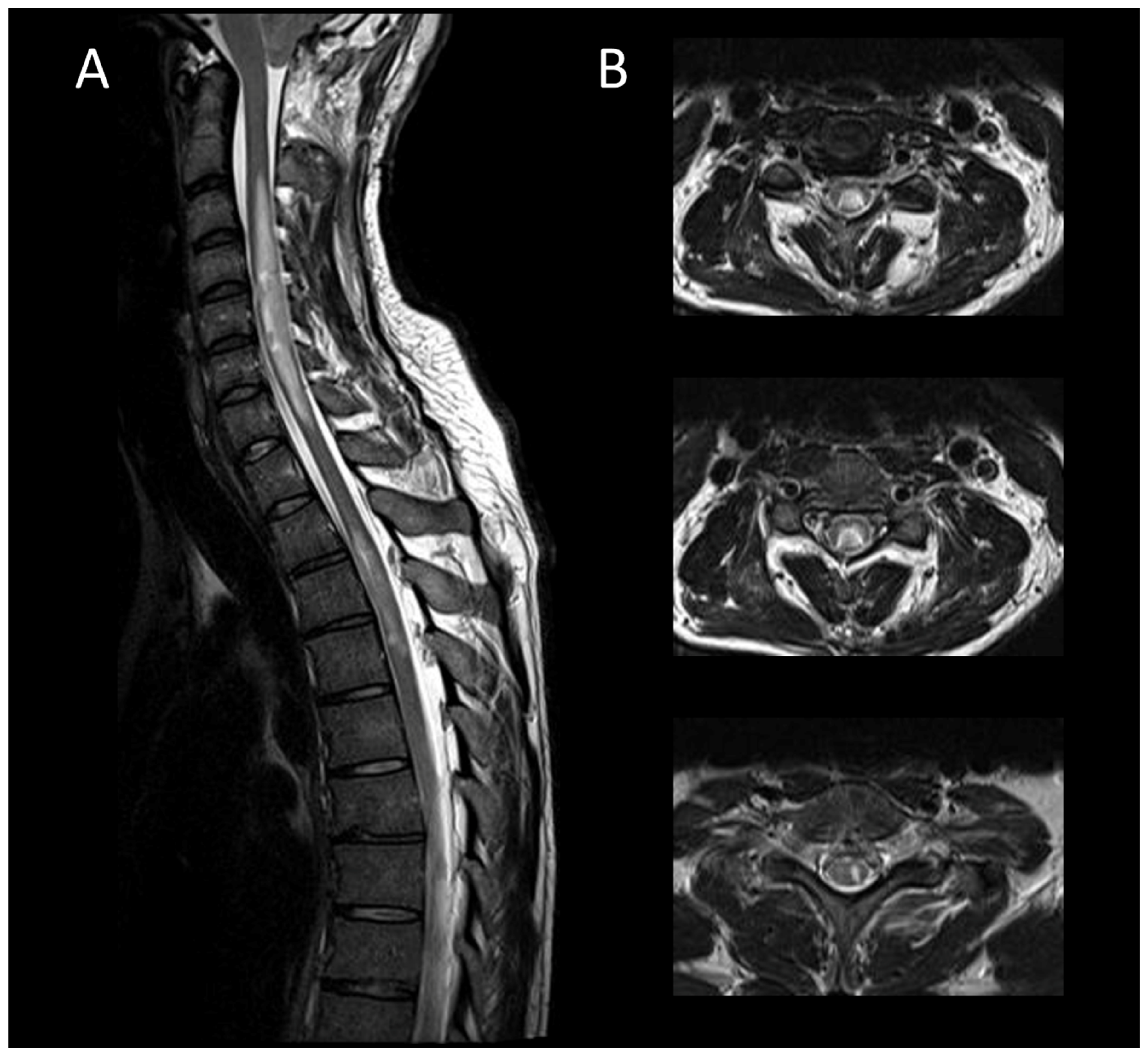 Cancers 16 01004 g008