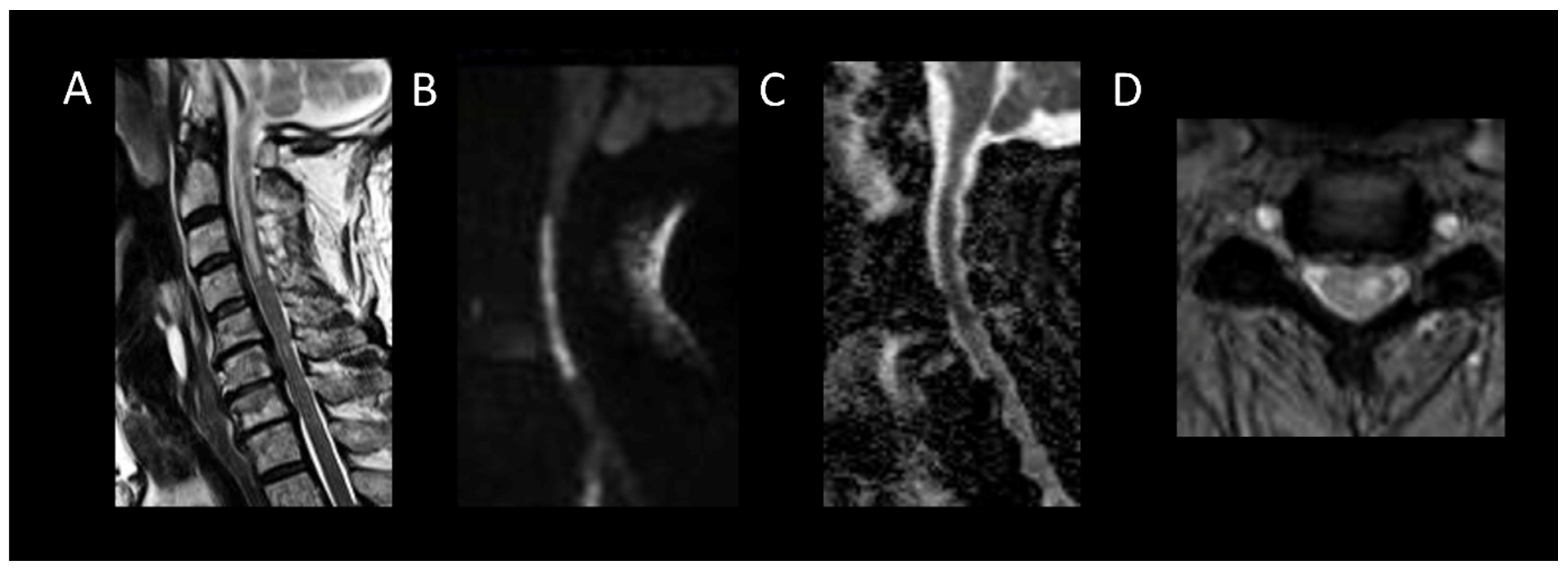 Cancers 16 01004 g009