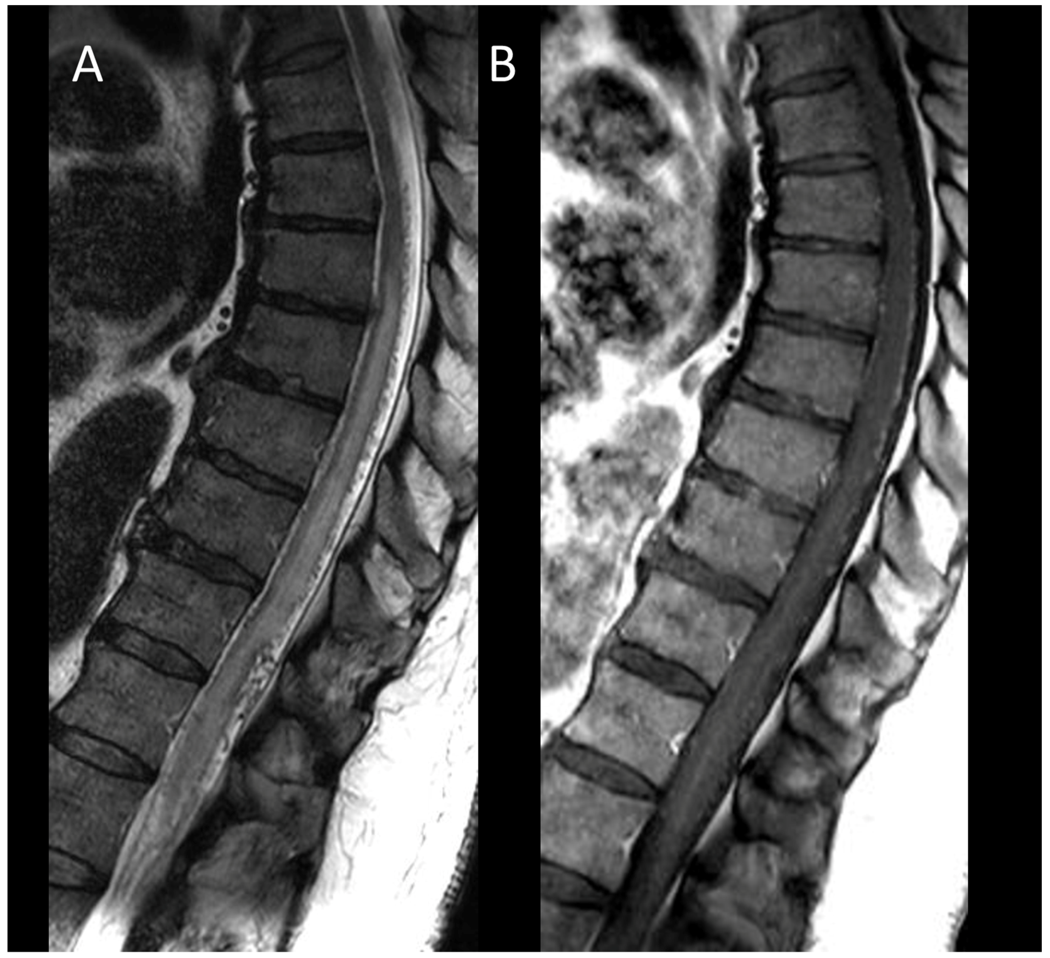 Cancers 16 01004 g010