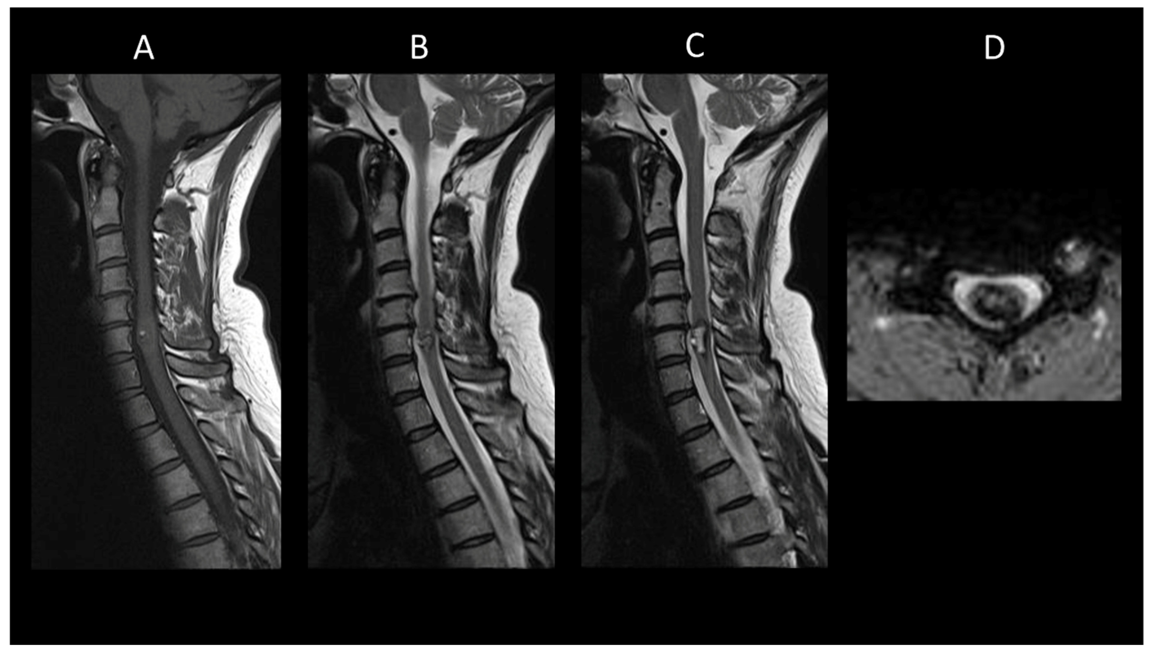 Cancers 16 01004 g011