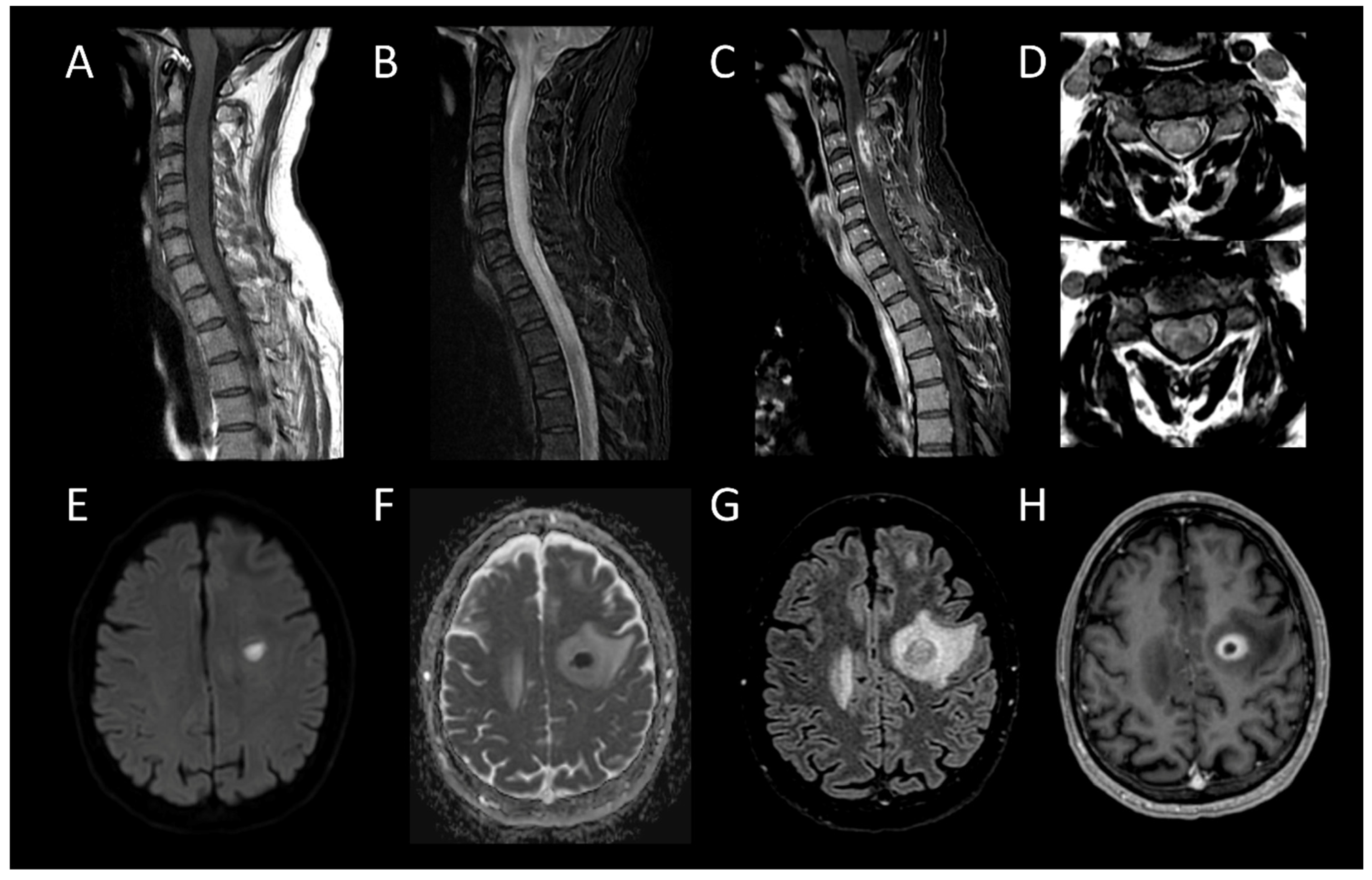Cancers 16 01004 g013