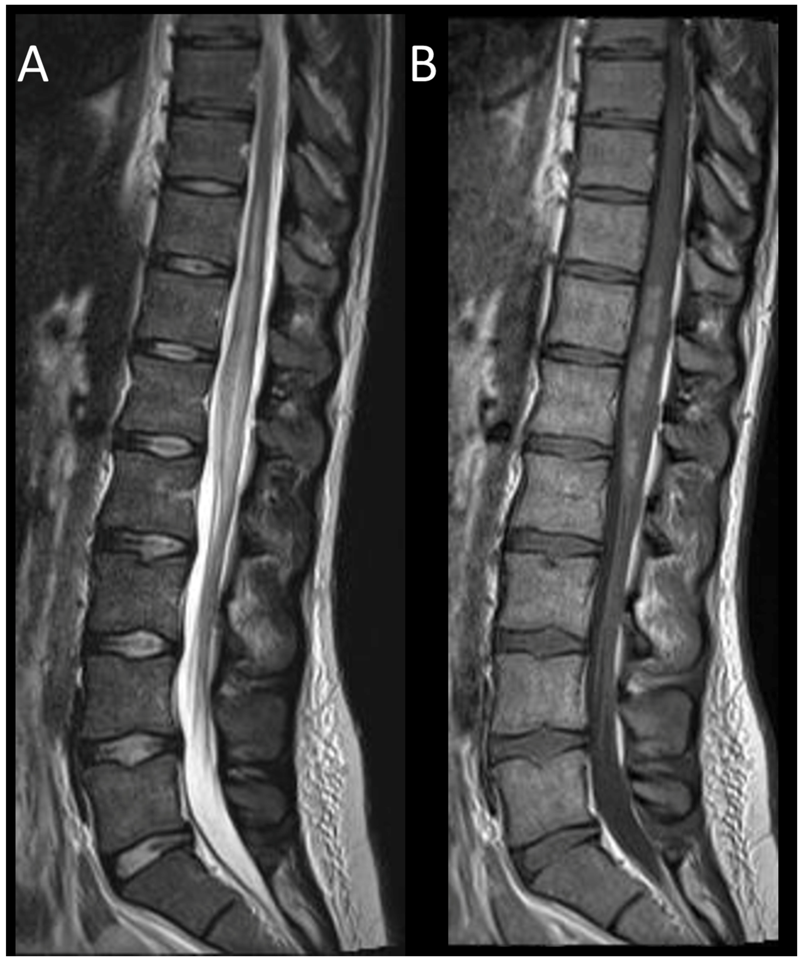 Cancers 16 01004 g014