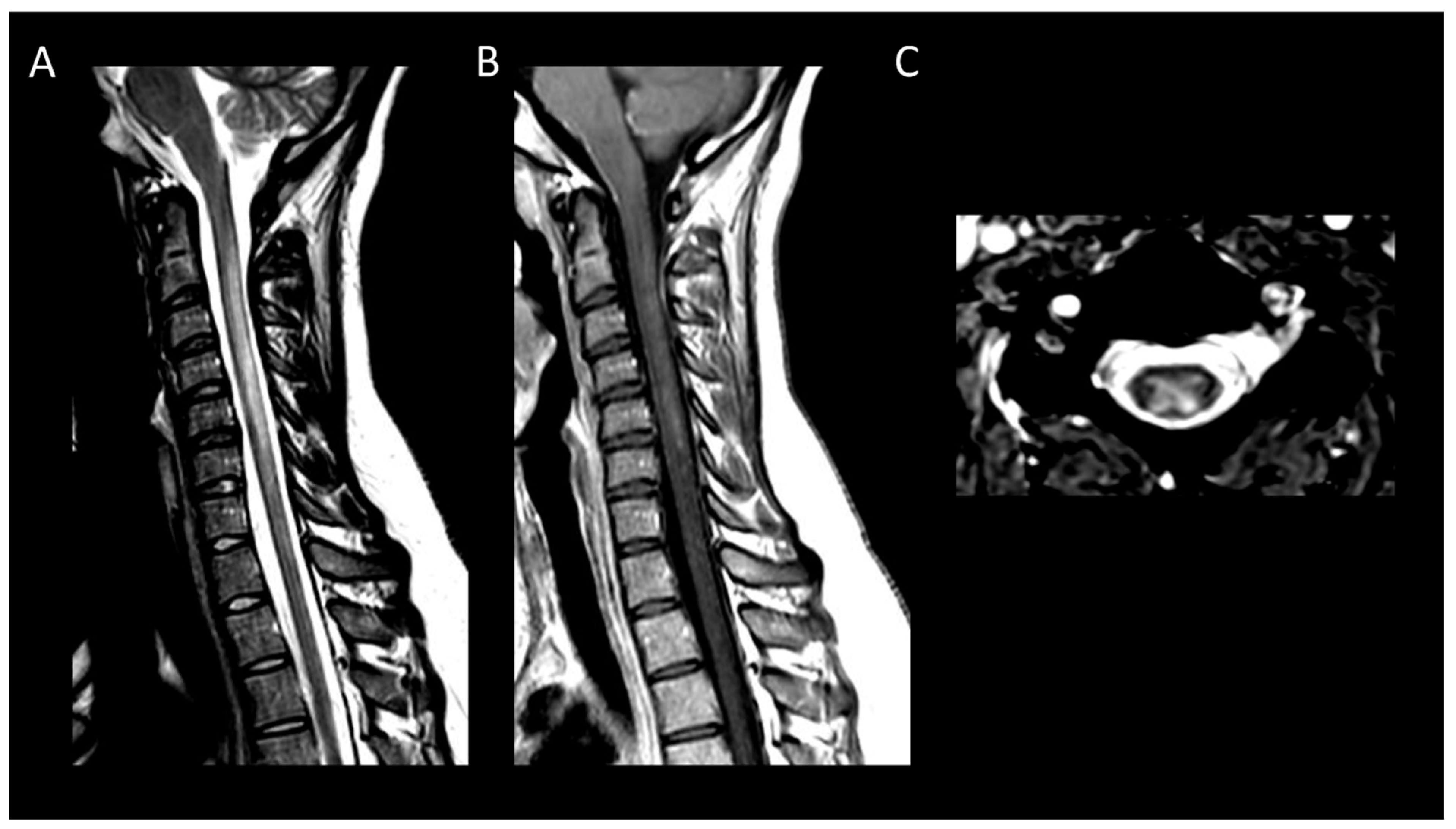 Cancers 16 01004 g015