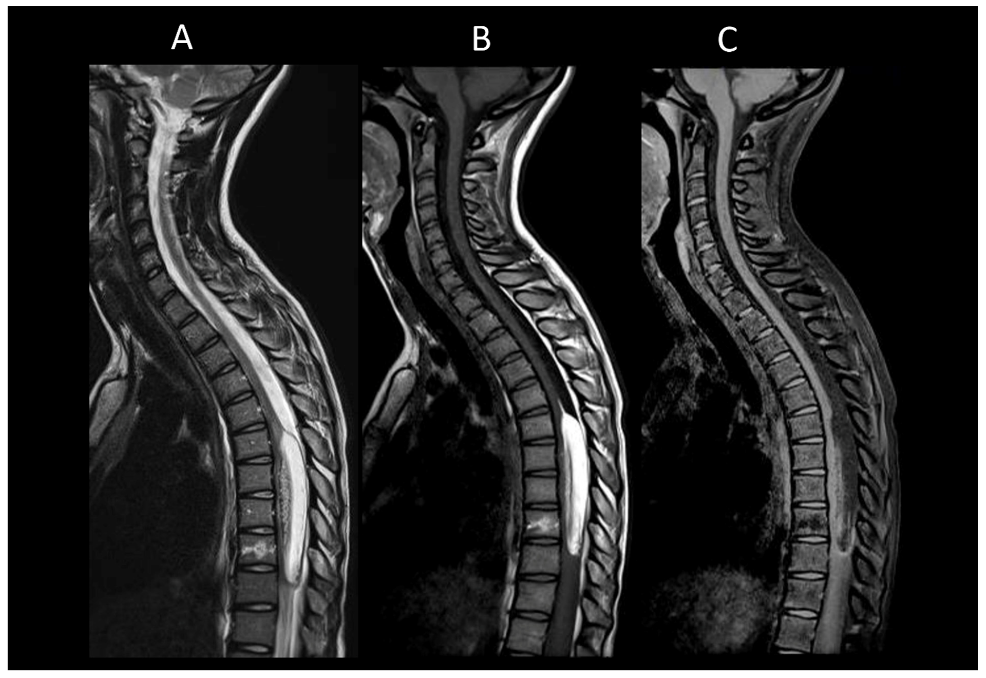 Cancers 16 01004 g016