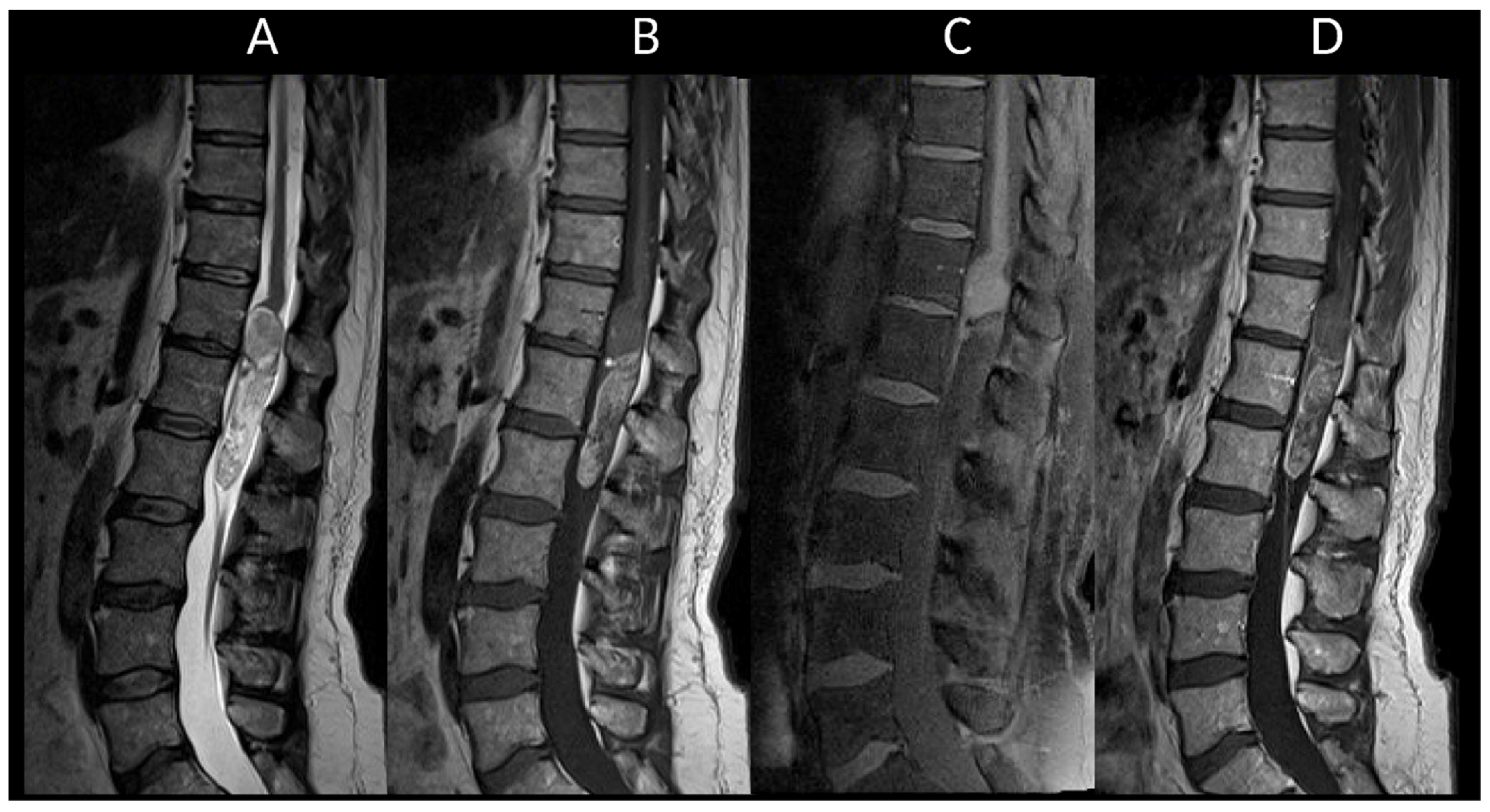 Cancers 16 01004 g017