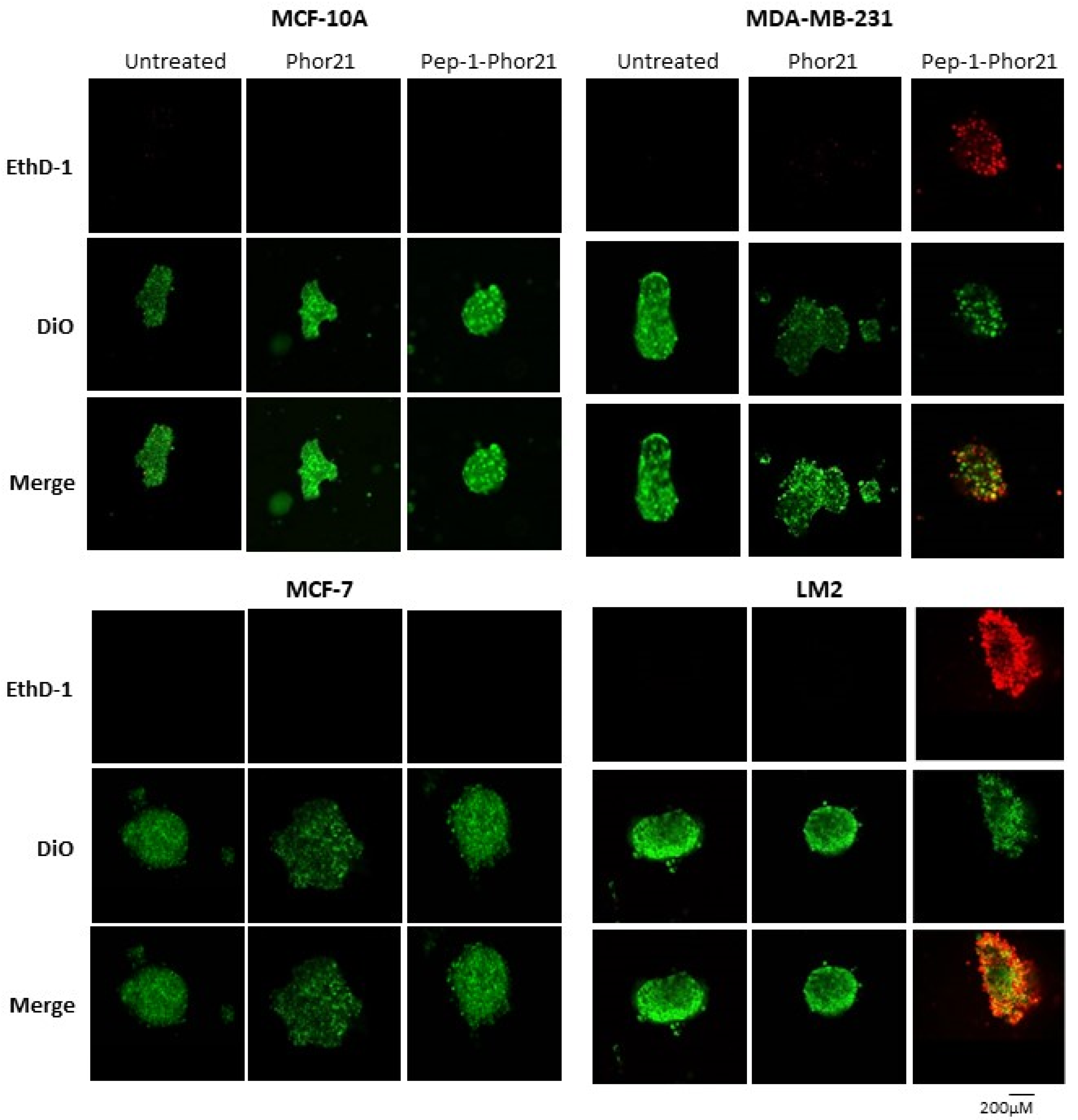 Cancers 16 01006 g009