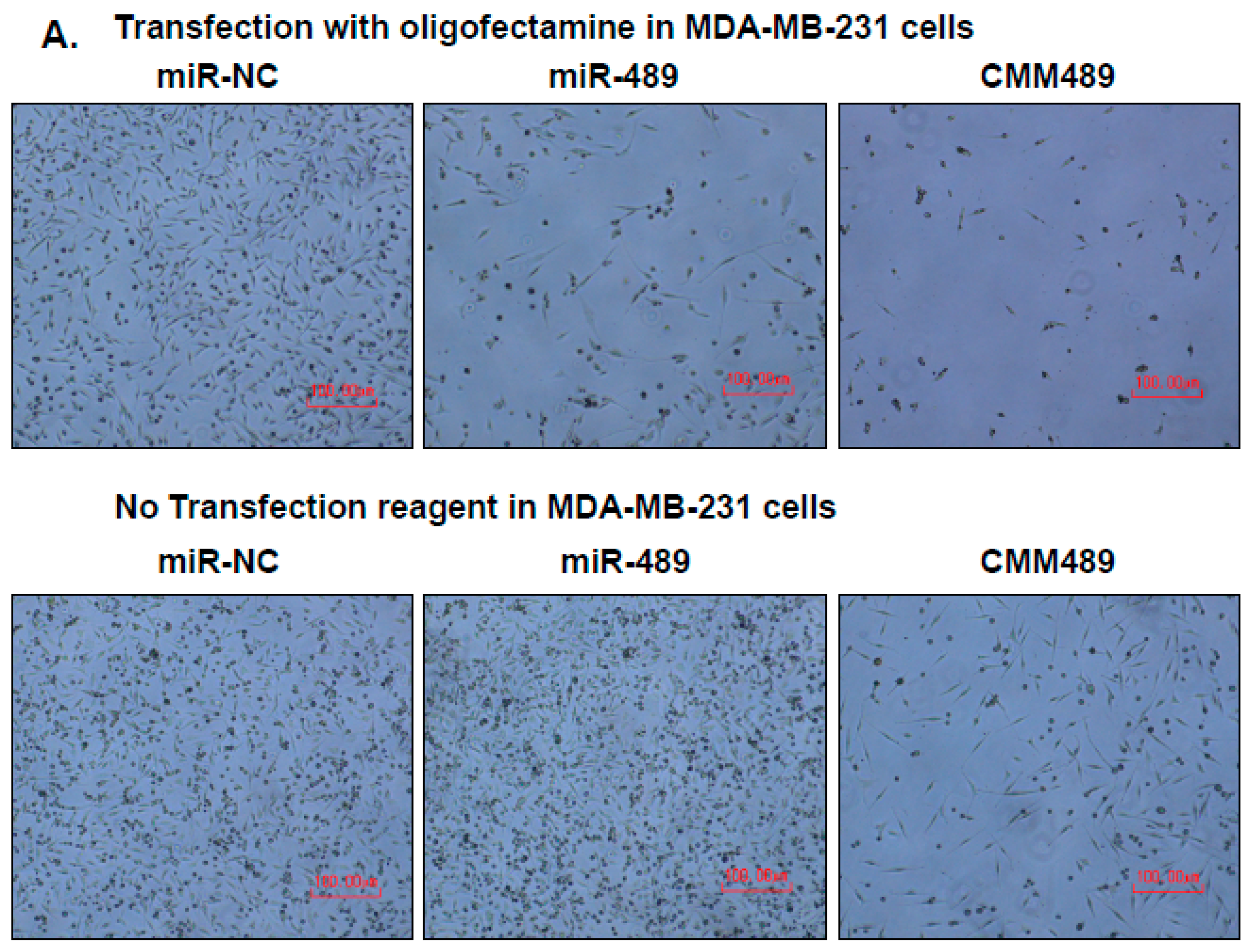Cancers 16 01010 g004a