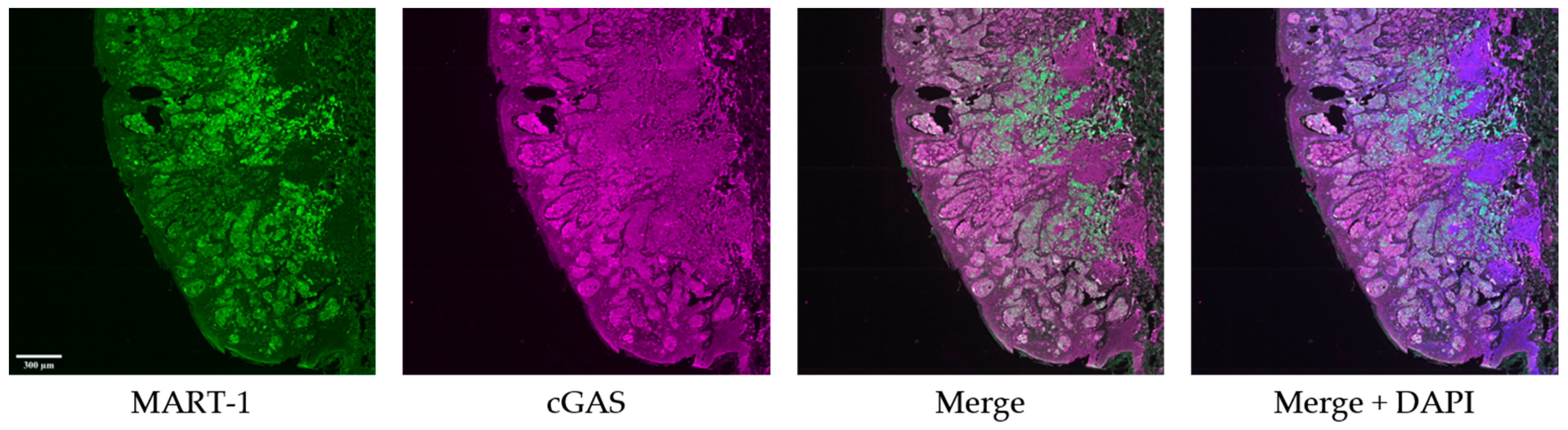 Cancers 16 01027 g002