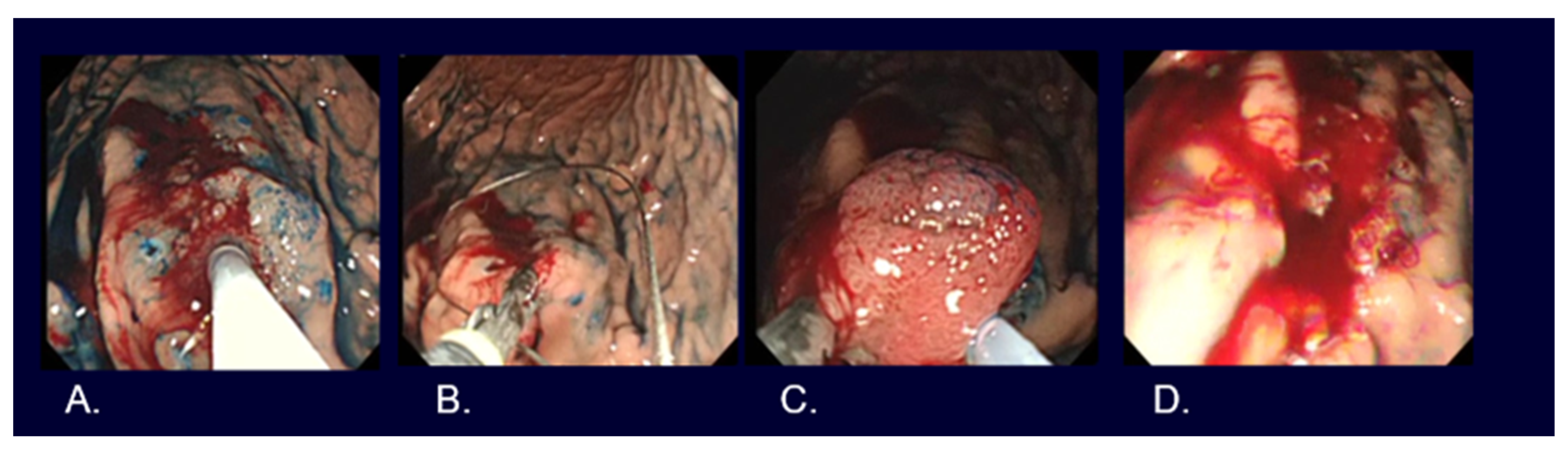 Cancers 16 01039 g004