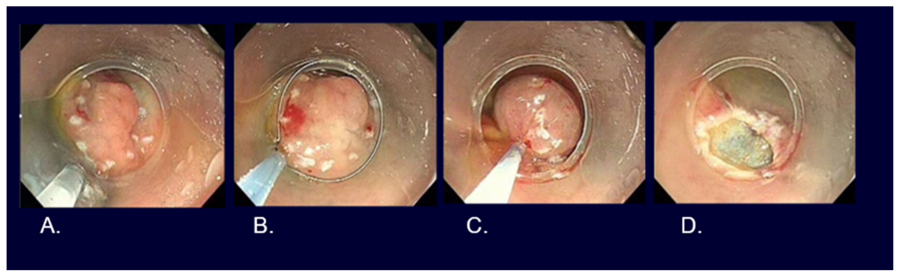 Cancers 16 01039 g005