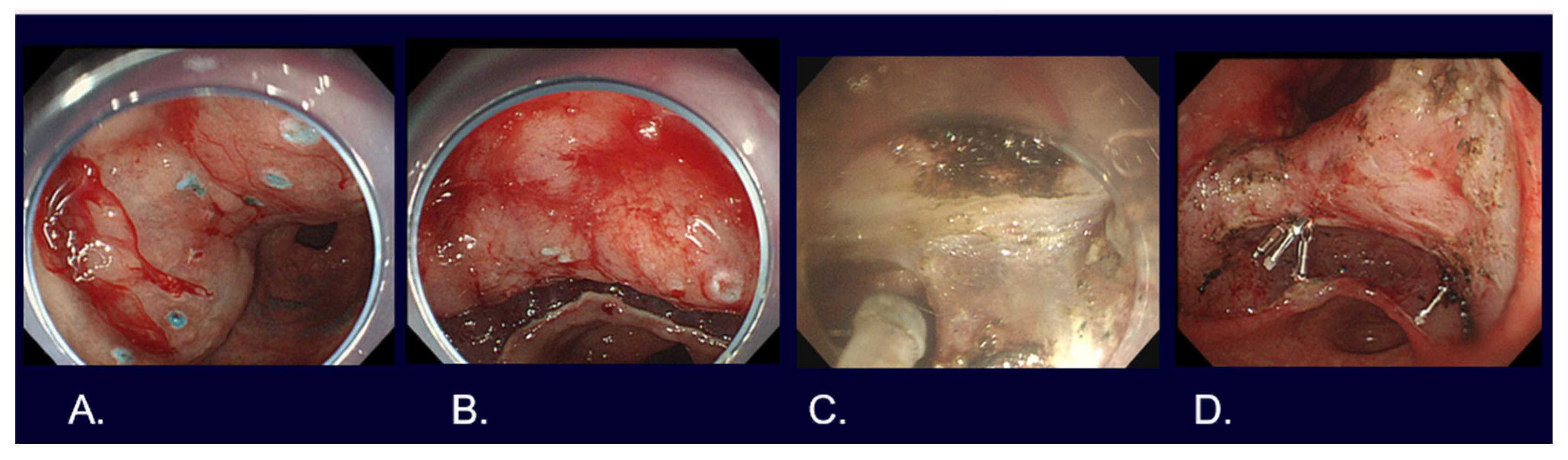 Cancers 16 01039 g006