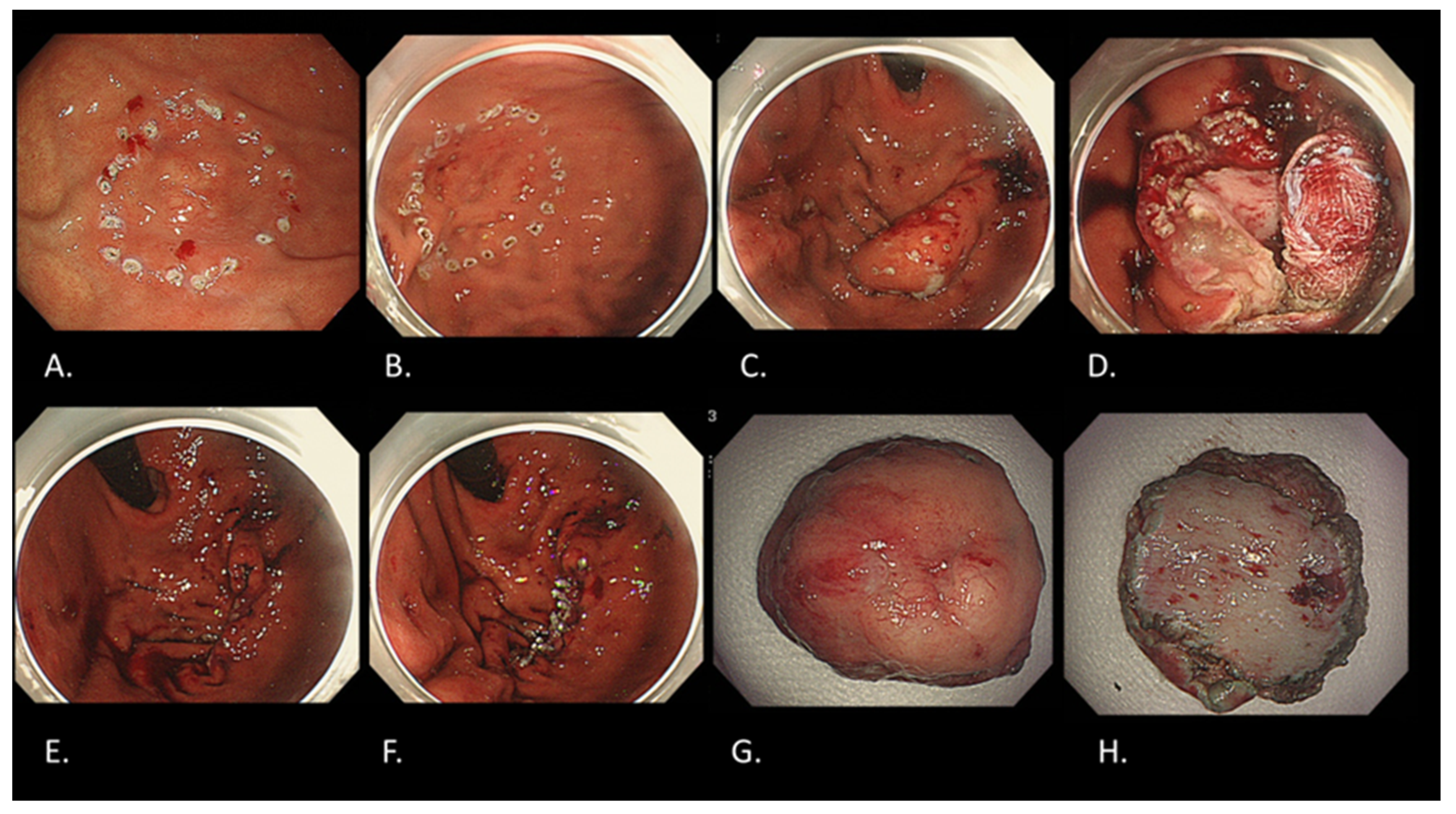 Cancers 16 01039 g008