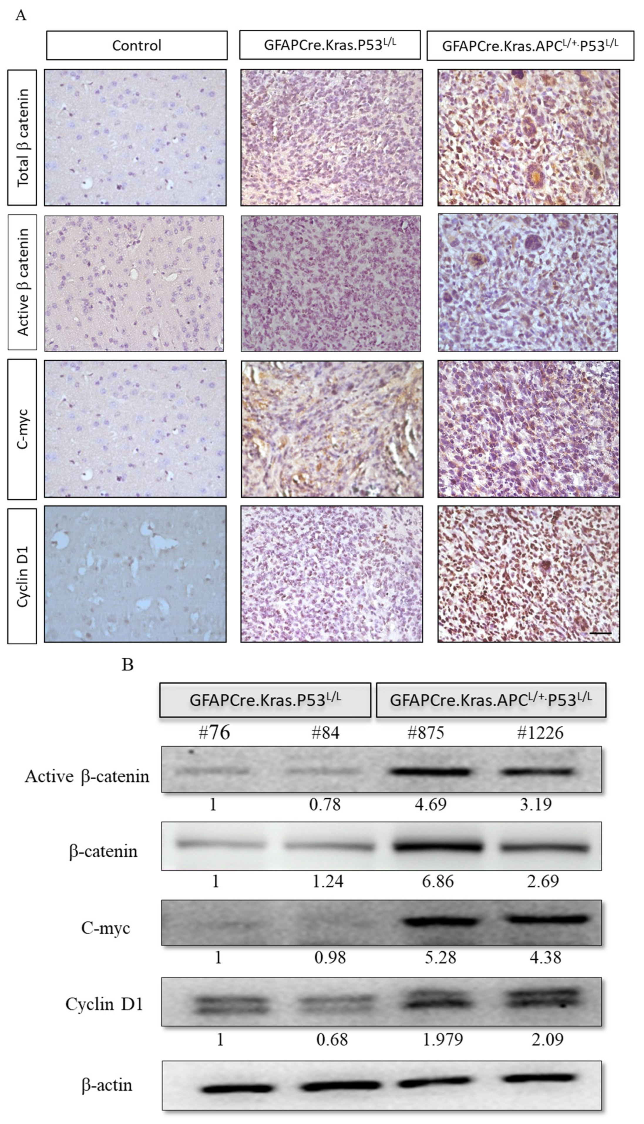 Cancers 16 01046 g004 Cancers 16 01046 g004