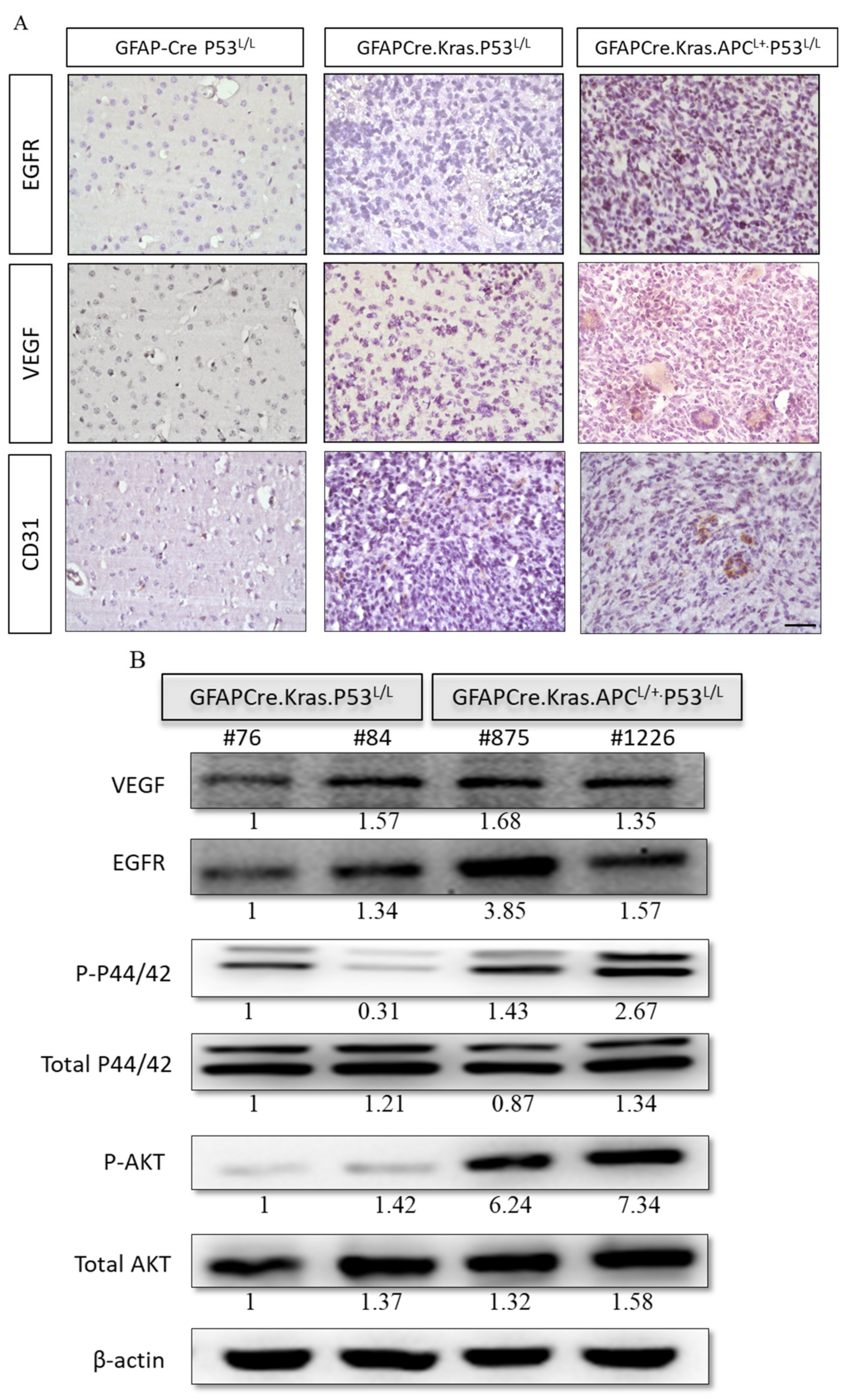 Cancers 16 01046 g006 Cancers 16 01046 g006