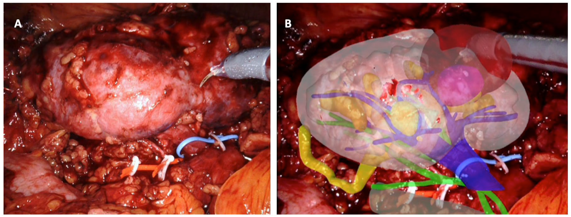 Cancers 16 01047 g001