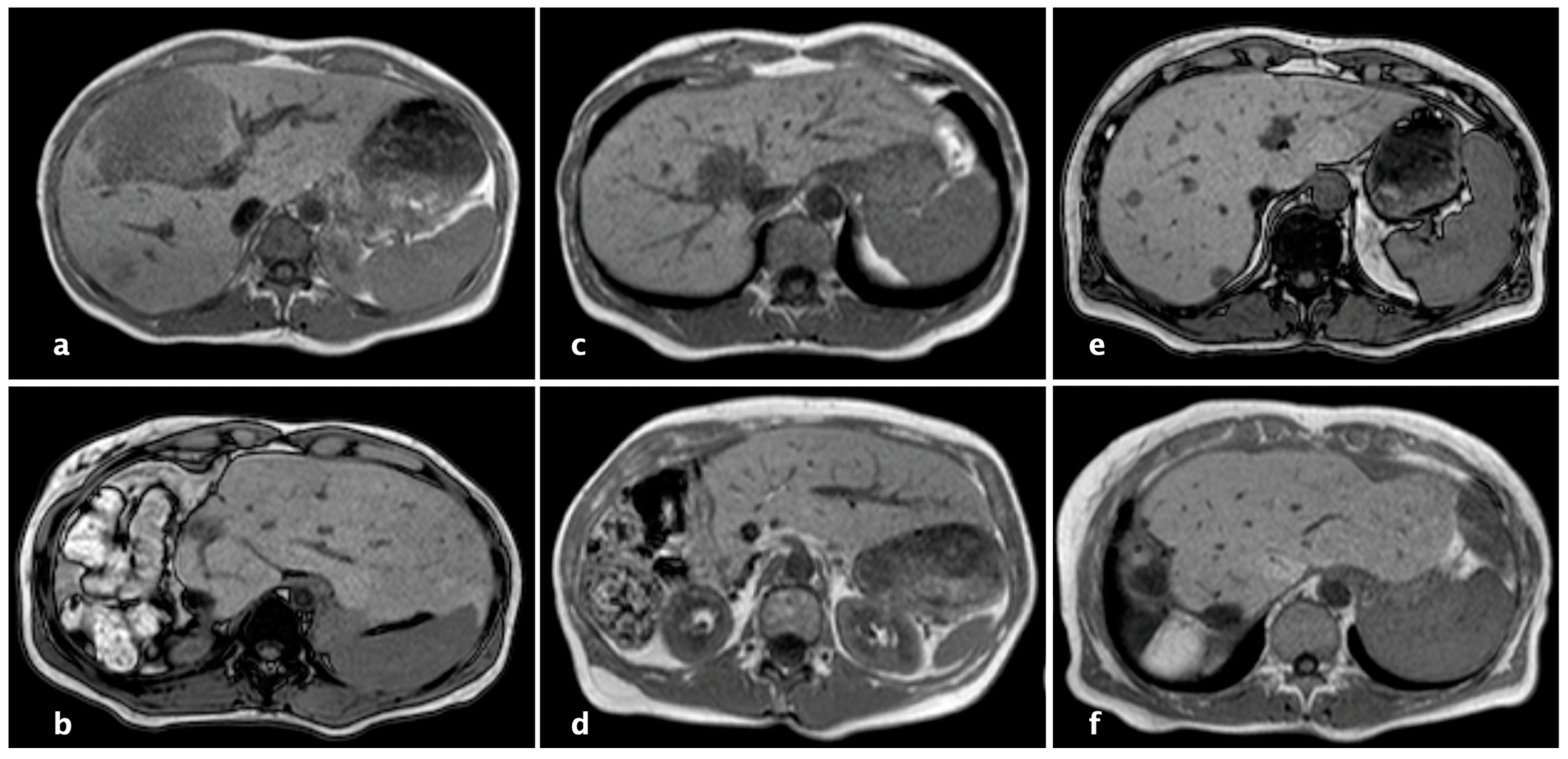 Cancers 16 01070 g003 Cancers 16 01070 g003