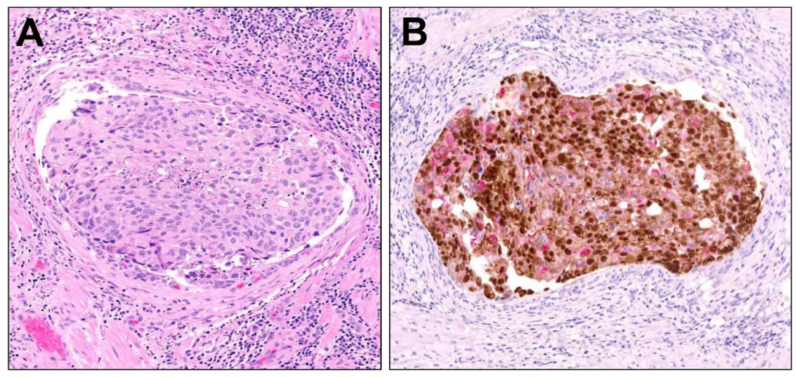 Cancers 16 01097 g004