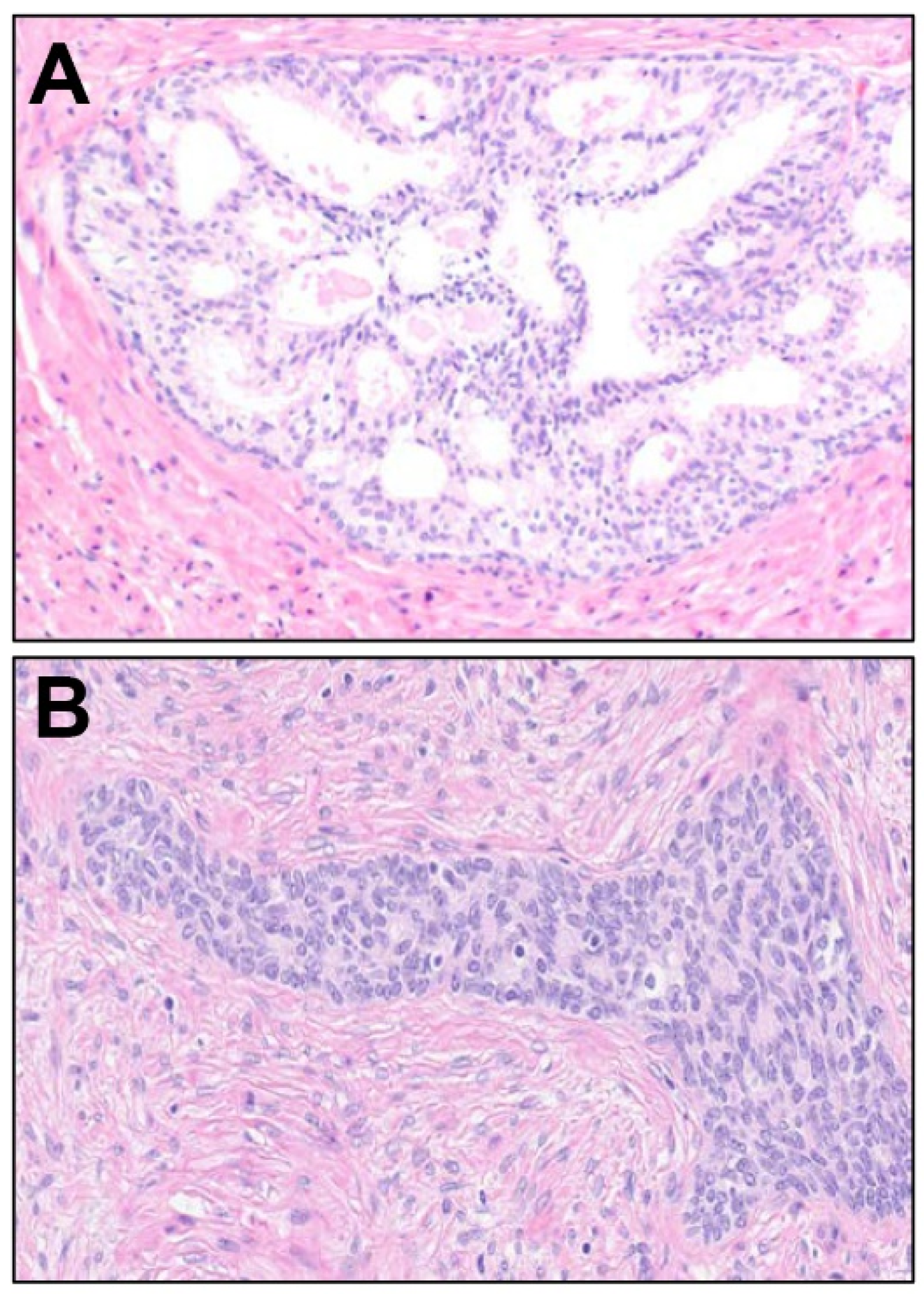 Cancers 16 01097 g006