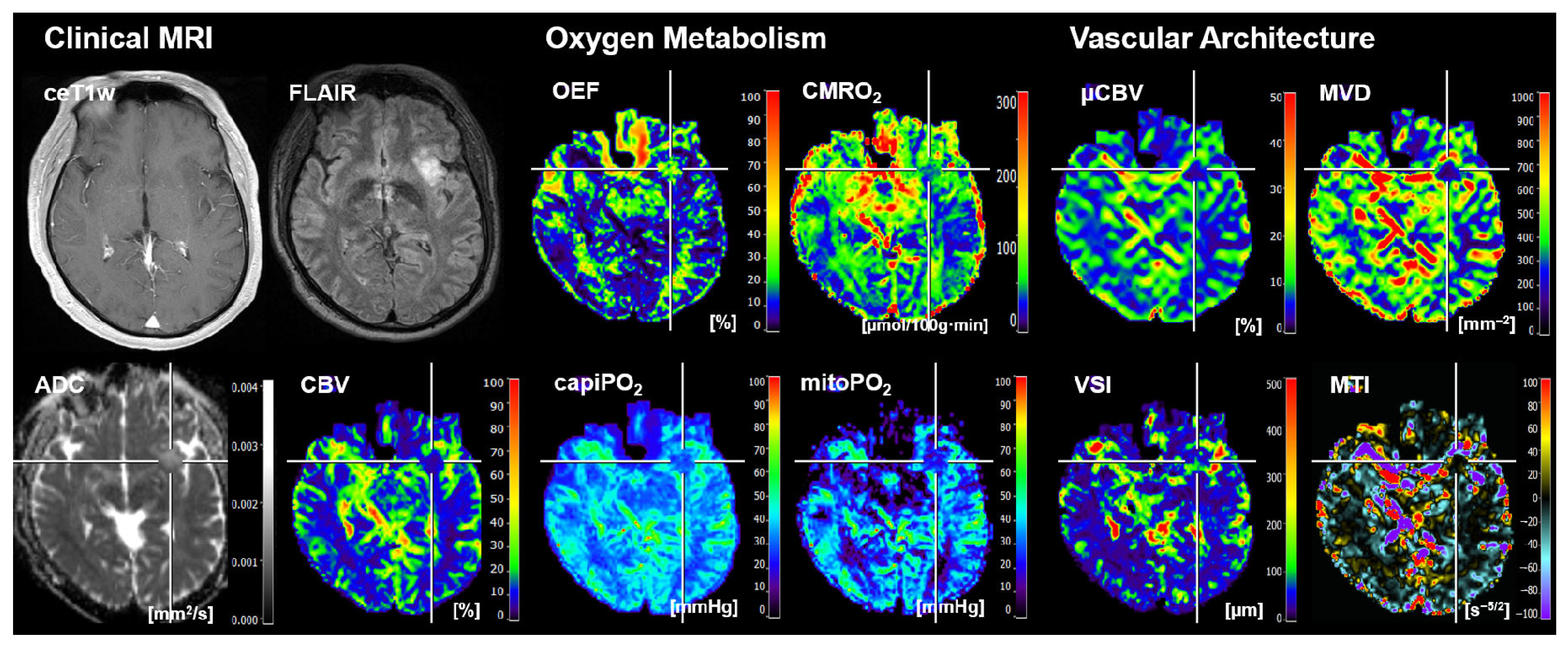Cancers 16 01102 g002