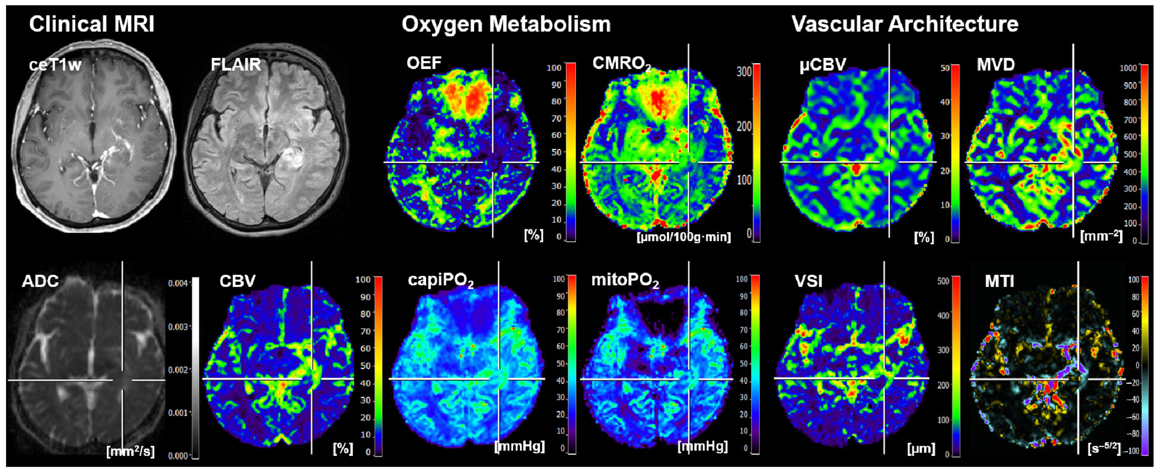 Cancers 16 01102 g003