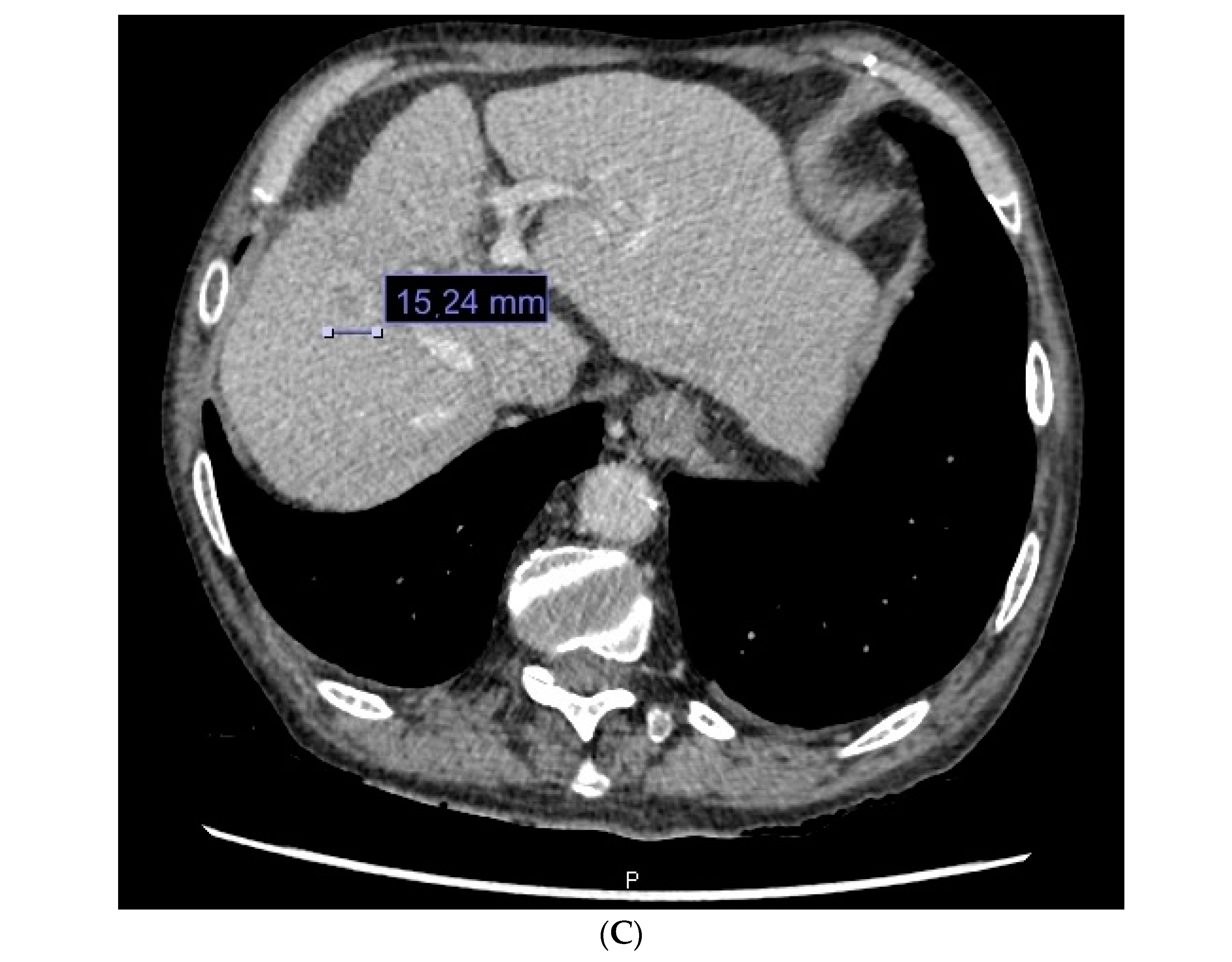 Cancers 16 01114 g005b