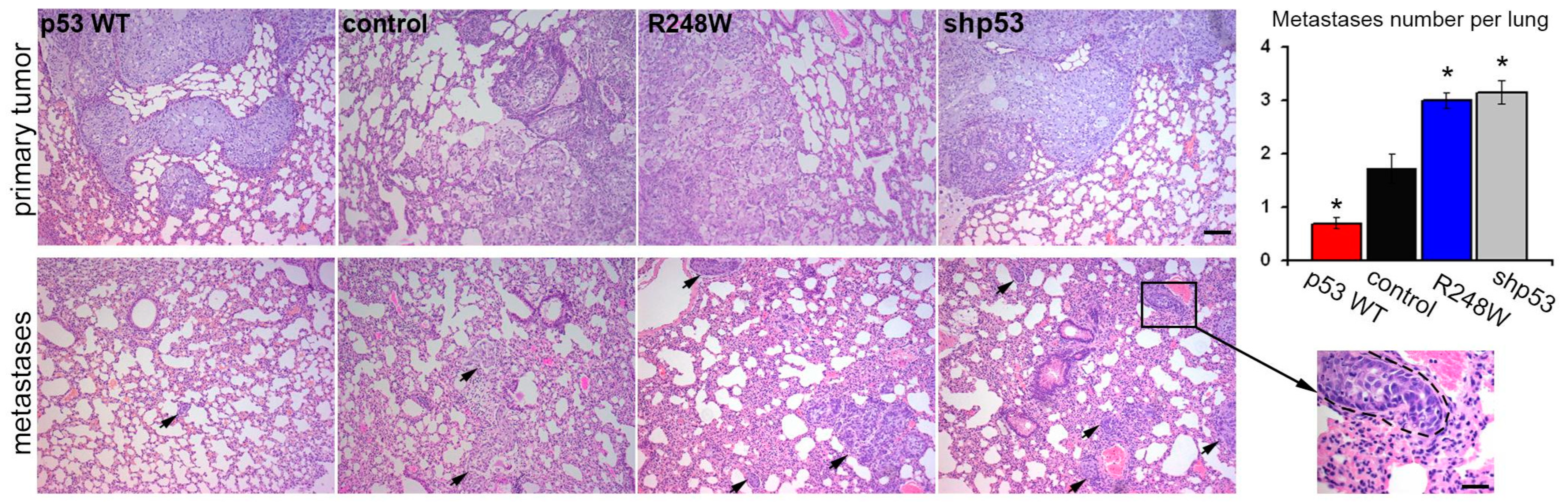 Cancers 16 01123 g003