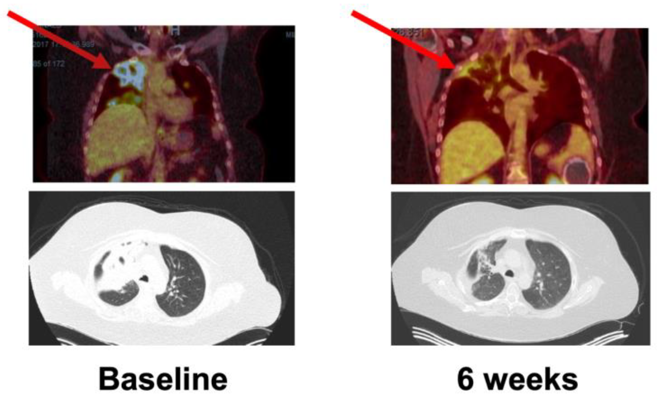 Cancers 16 01137 g001