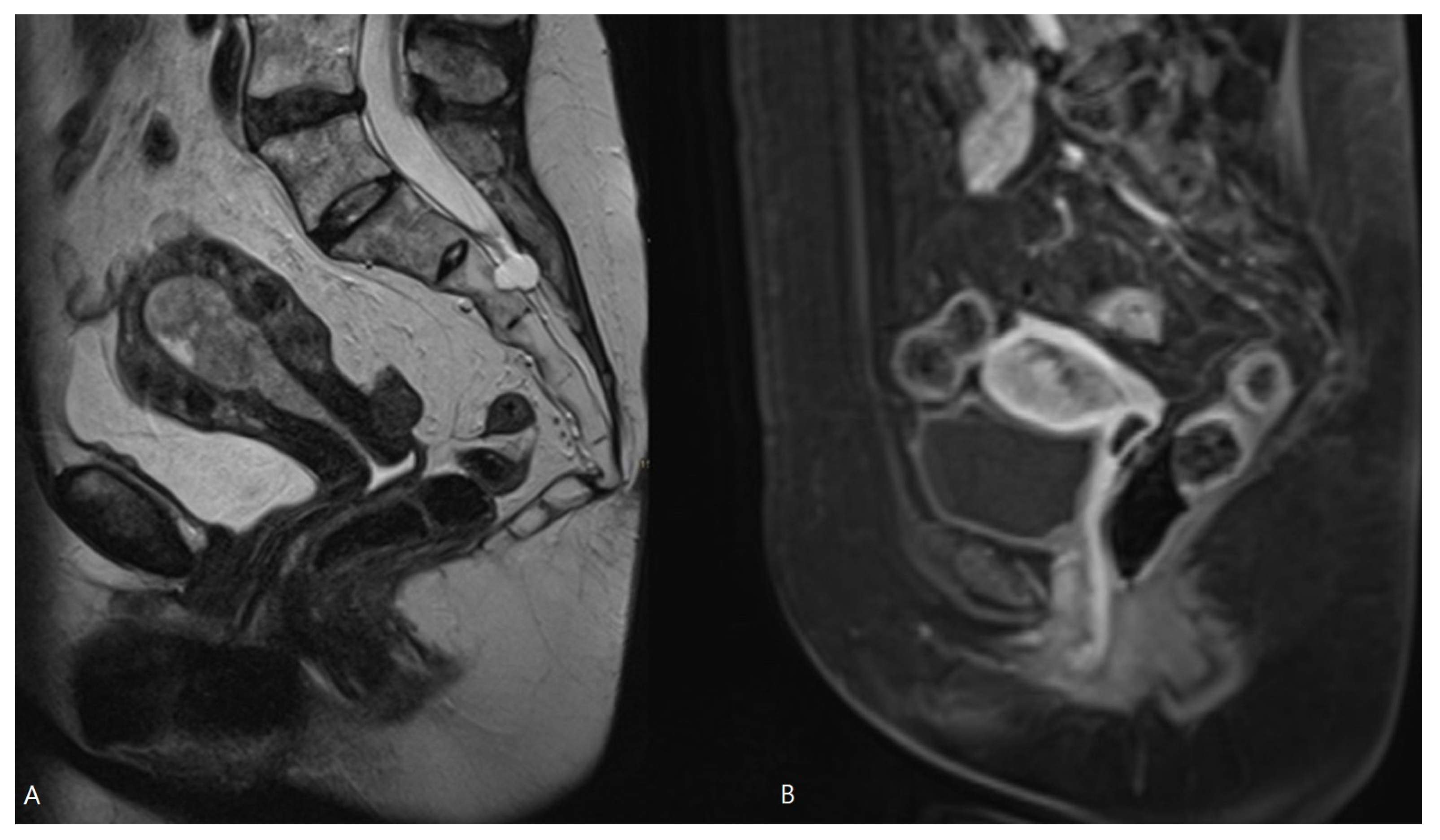 Cancers 16 01142 g004