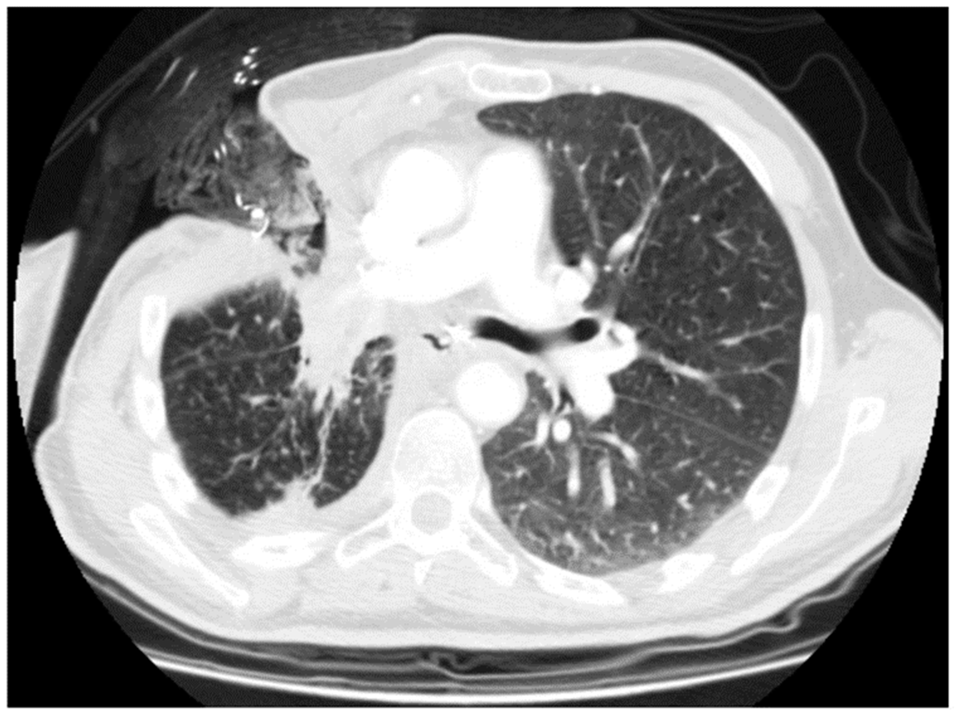 Cancers 16 01146 g003 Cancers 16 01146 g003