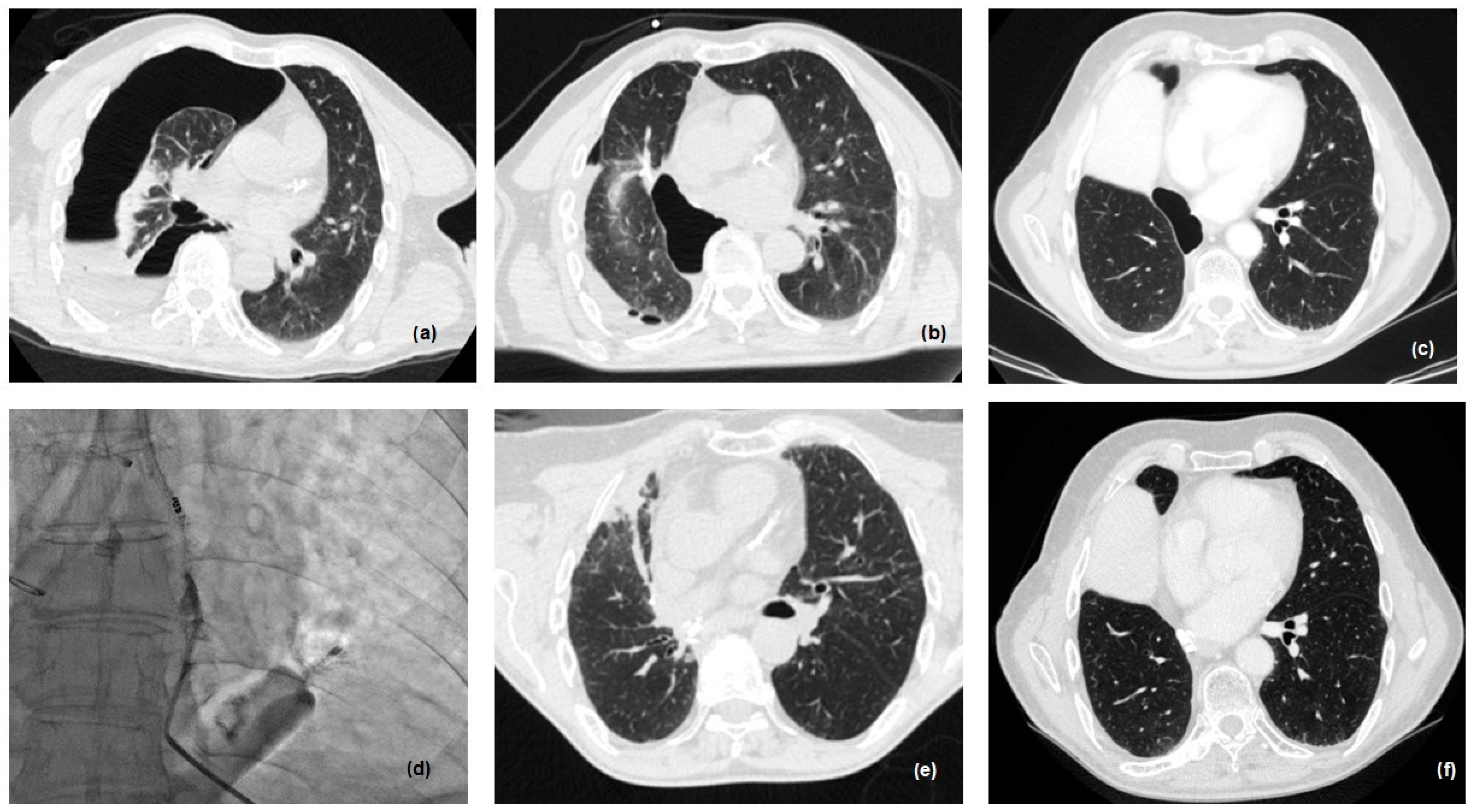 Cancers 16 01146 g004 Cancers 16 01146 g004