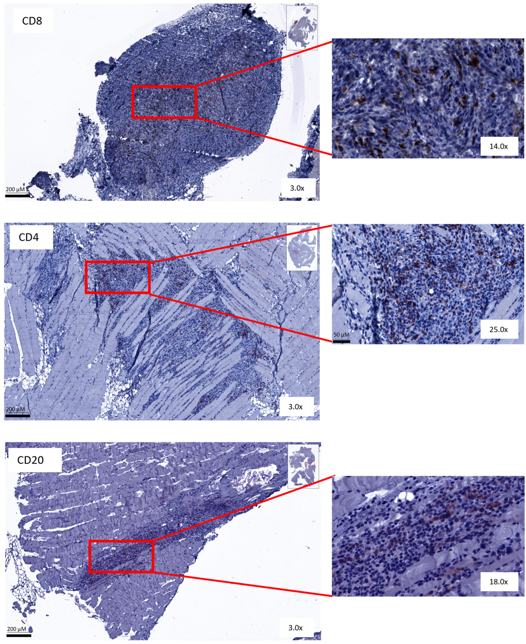 Cancers 16 01147 g007