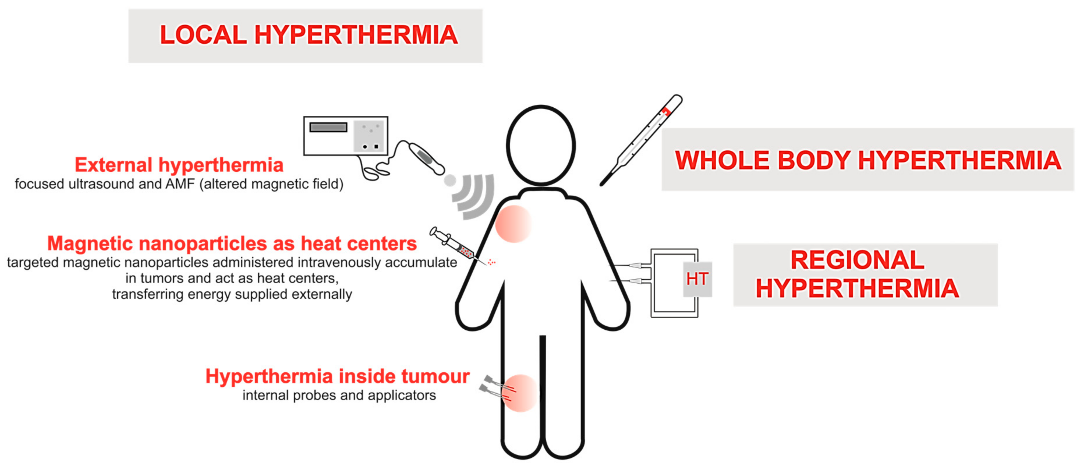 Application of Nanoparticles for Magnetic Hyperthermia for Cancer 