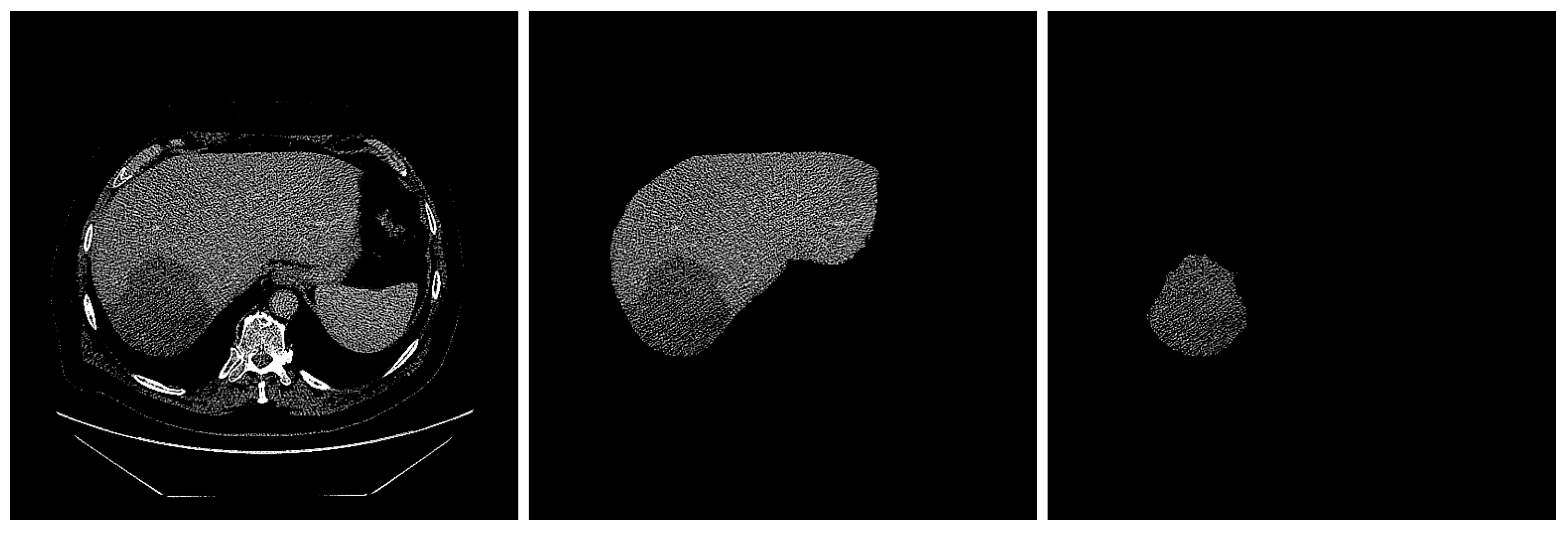 Cancers 16 01158 g002