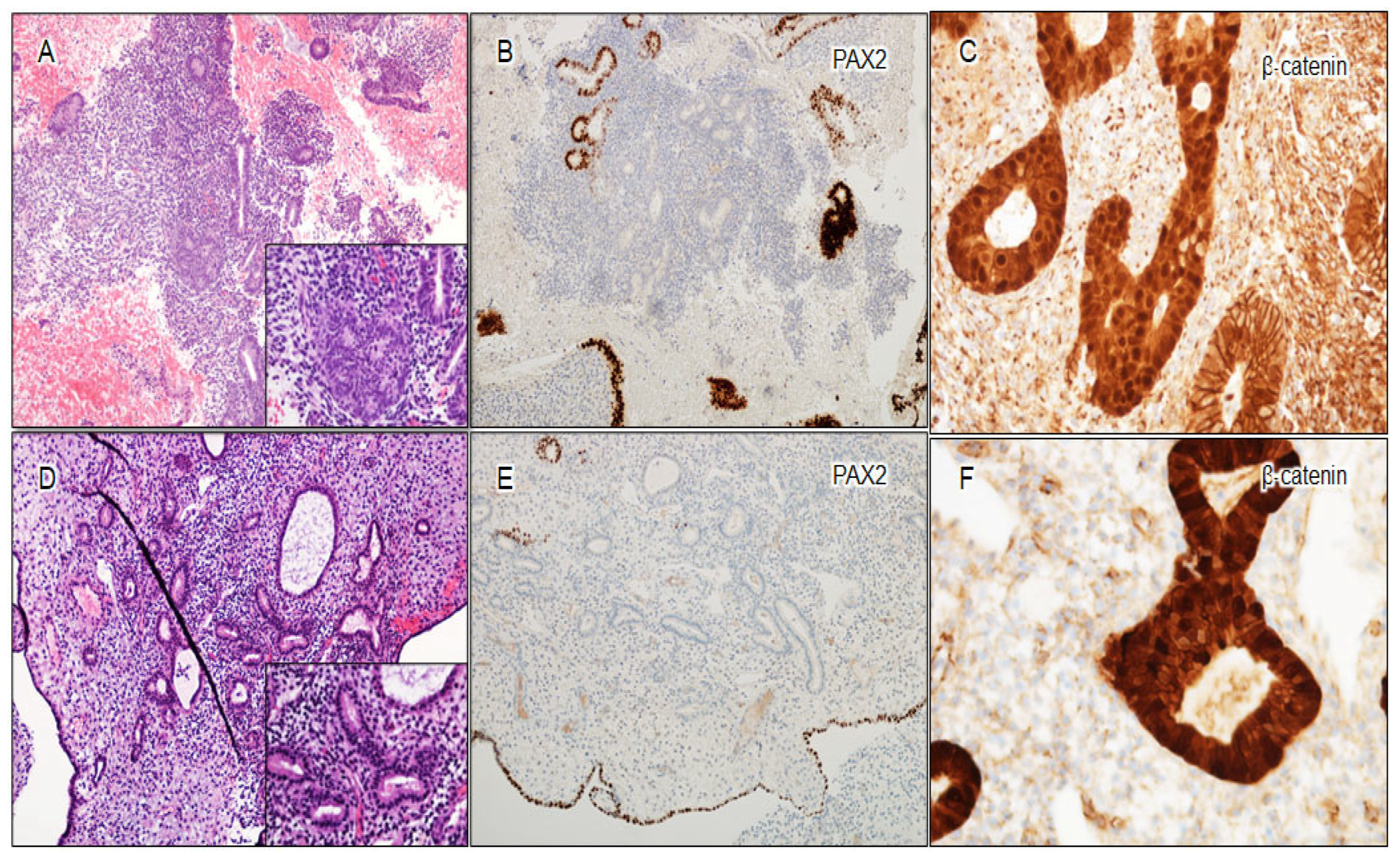 Cancers 16 01159 g005 Cancers 16 01159 g005