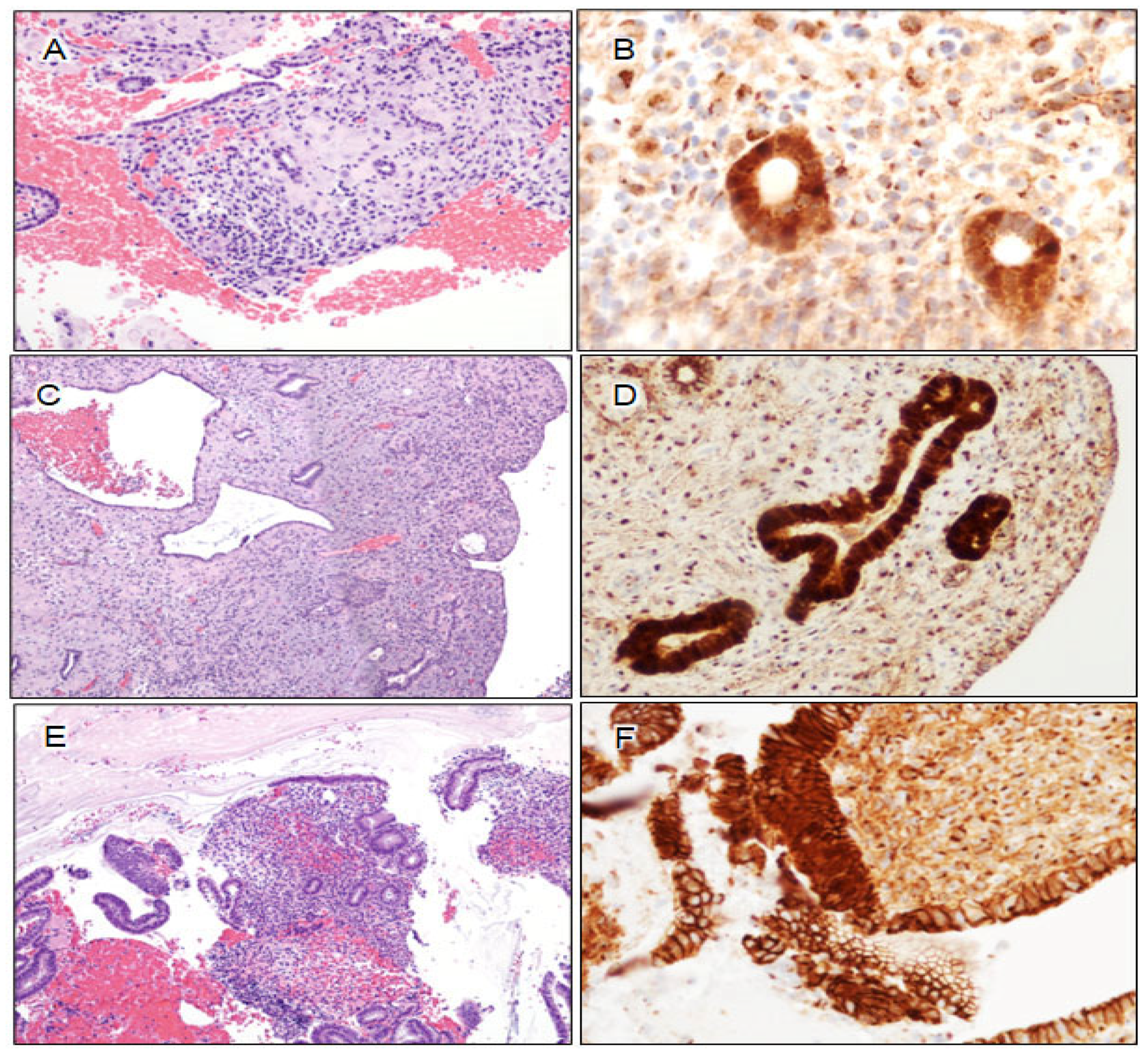 Cancers 16 01159 g006 Cancers 16 01159 g006