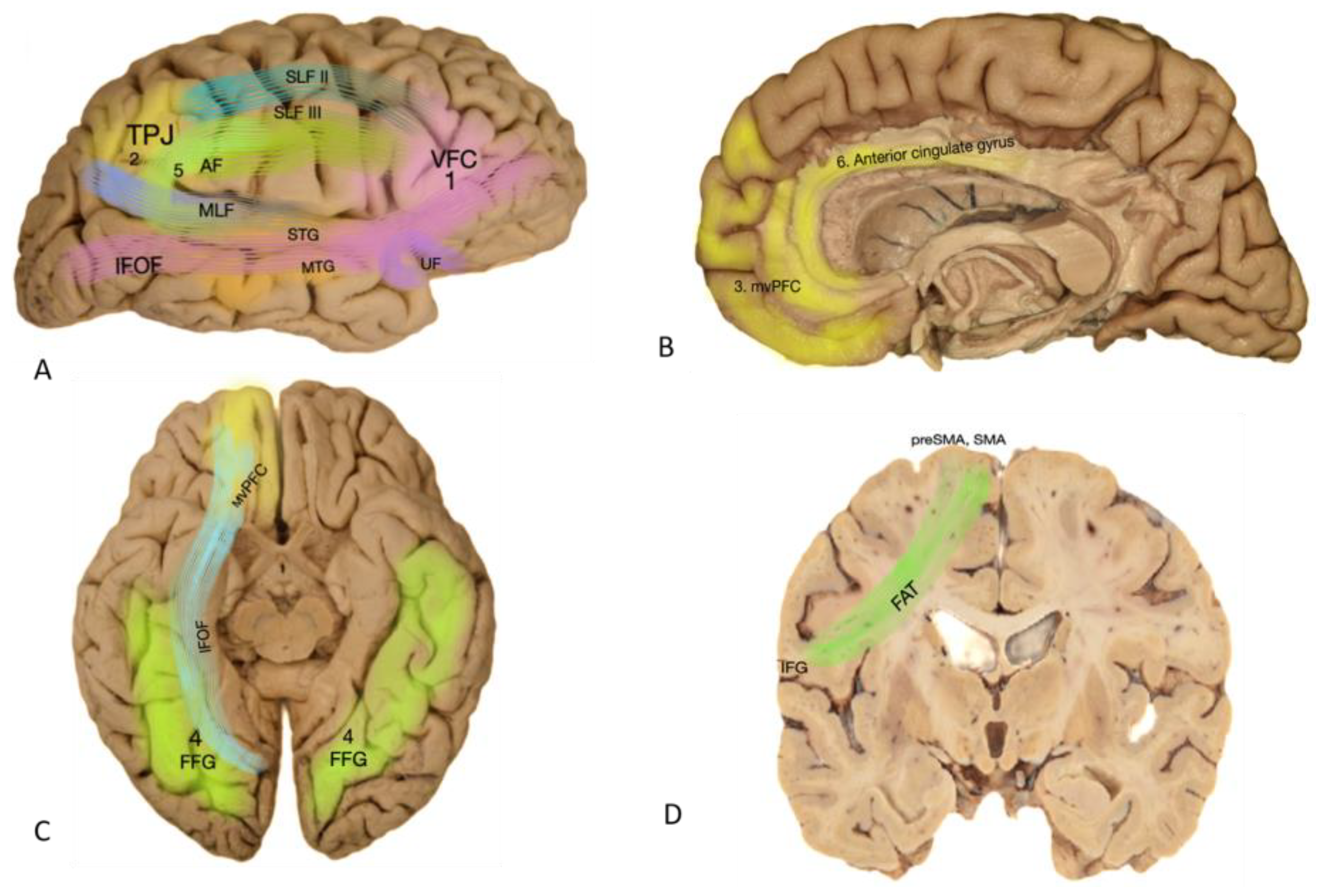 Cancers 16 01161 g002