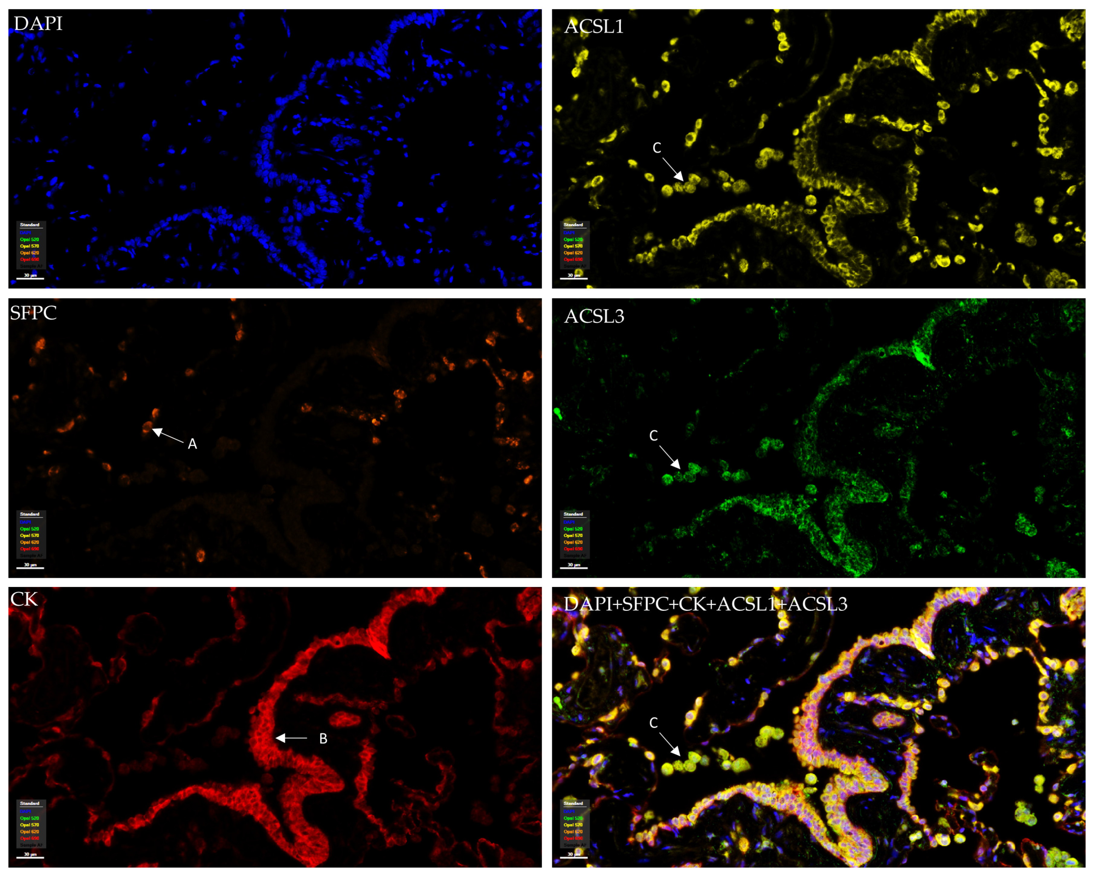 Cancers 16 01170 g002 Cancers 16 01170 g002