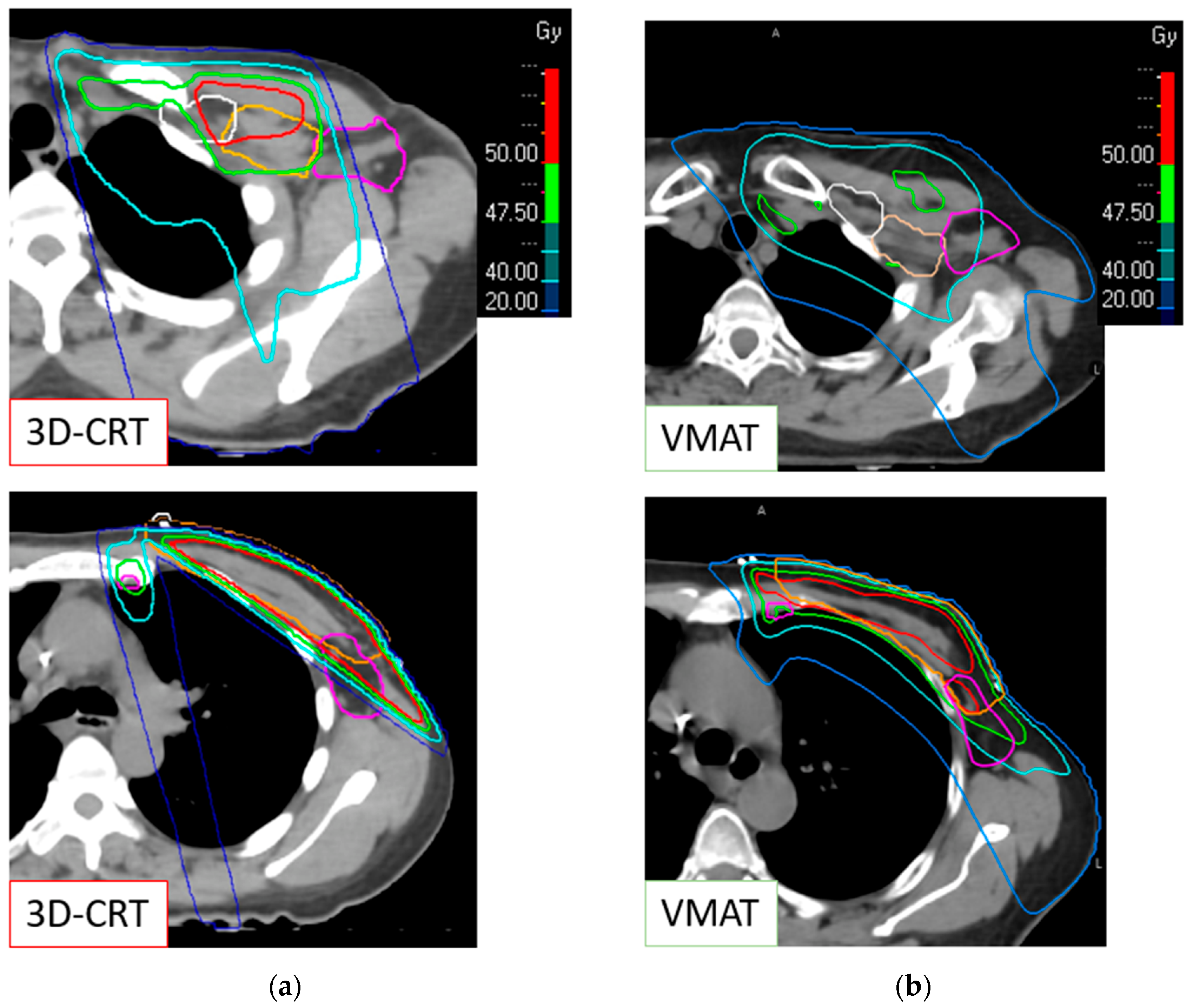 Cancers 16 01198 g001 Cancers 16 01198 g001