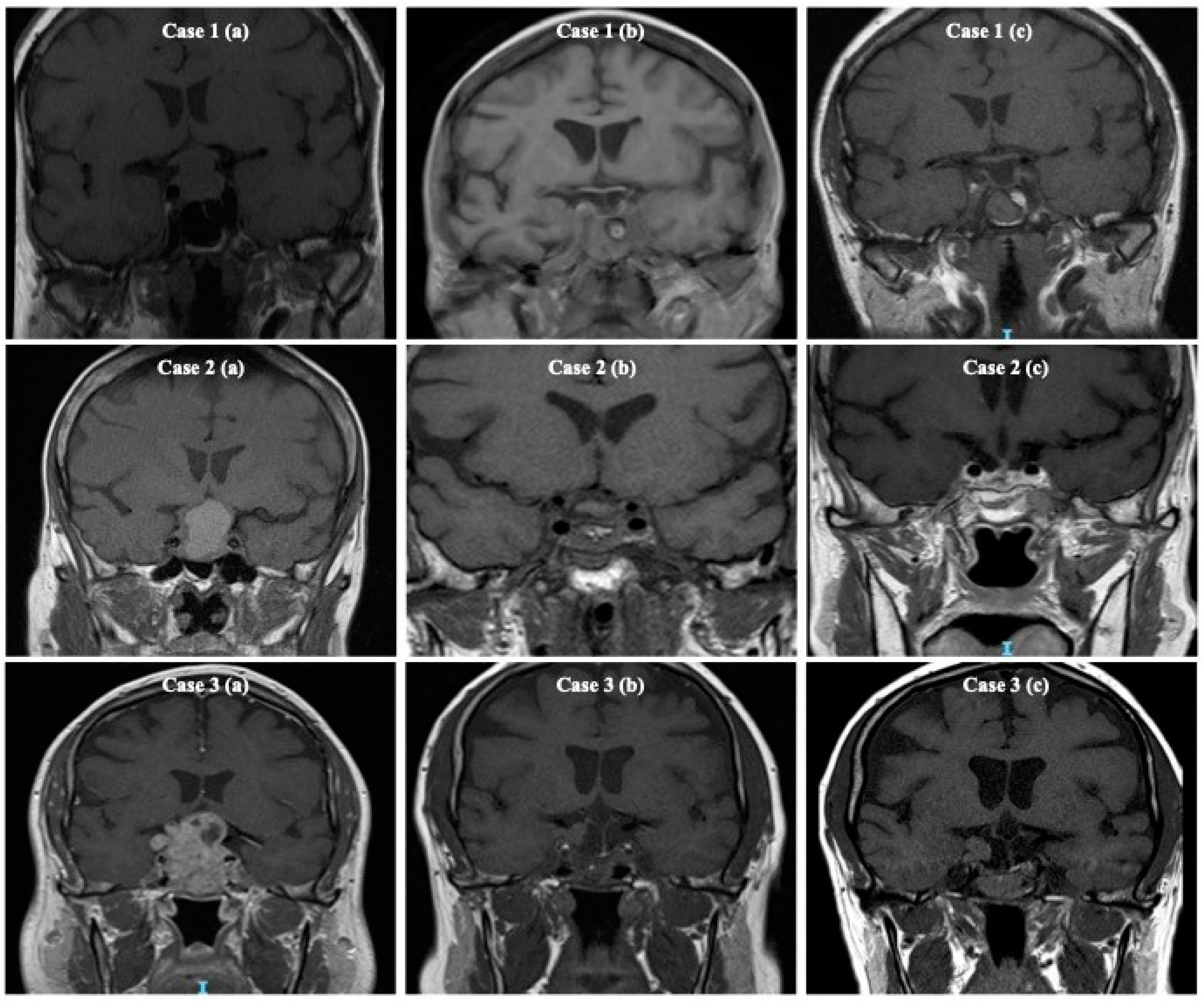 Cancers 16 01199 g001