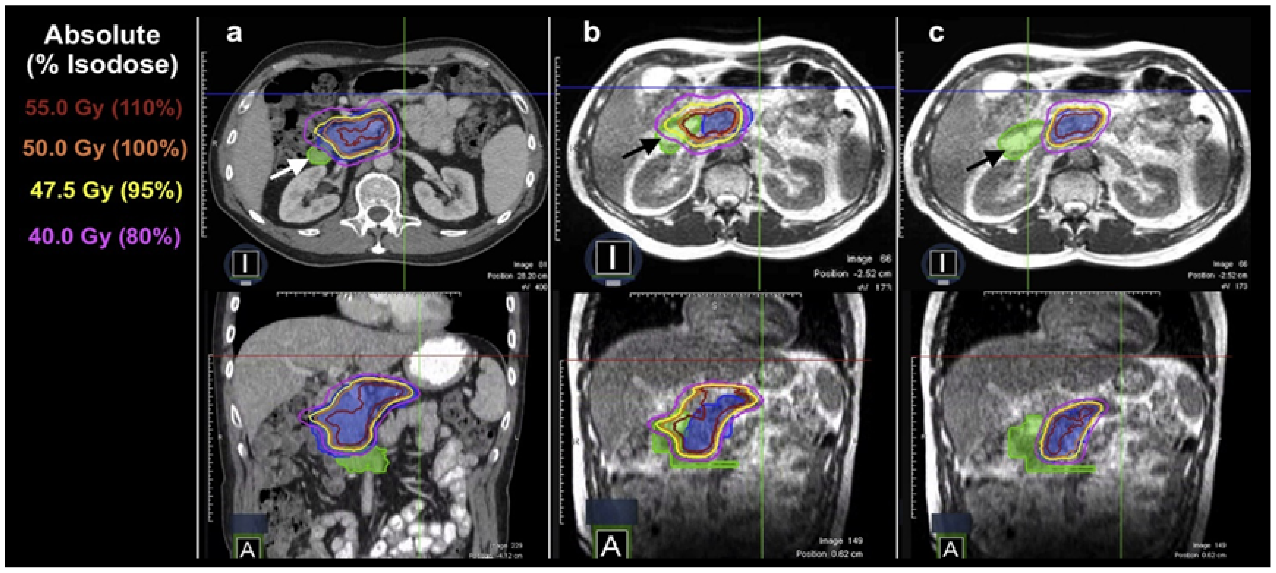 Cancers 16 01206 g004