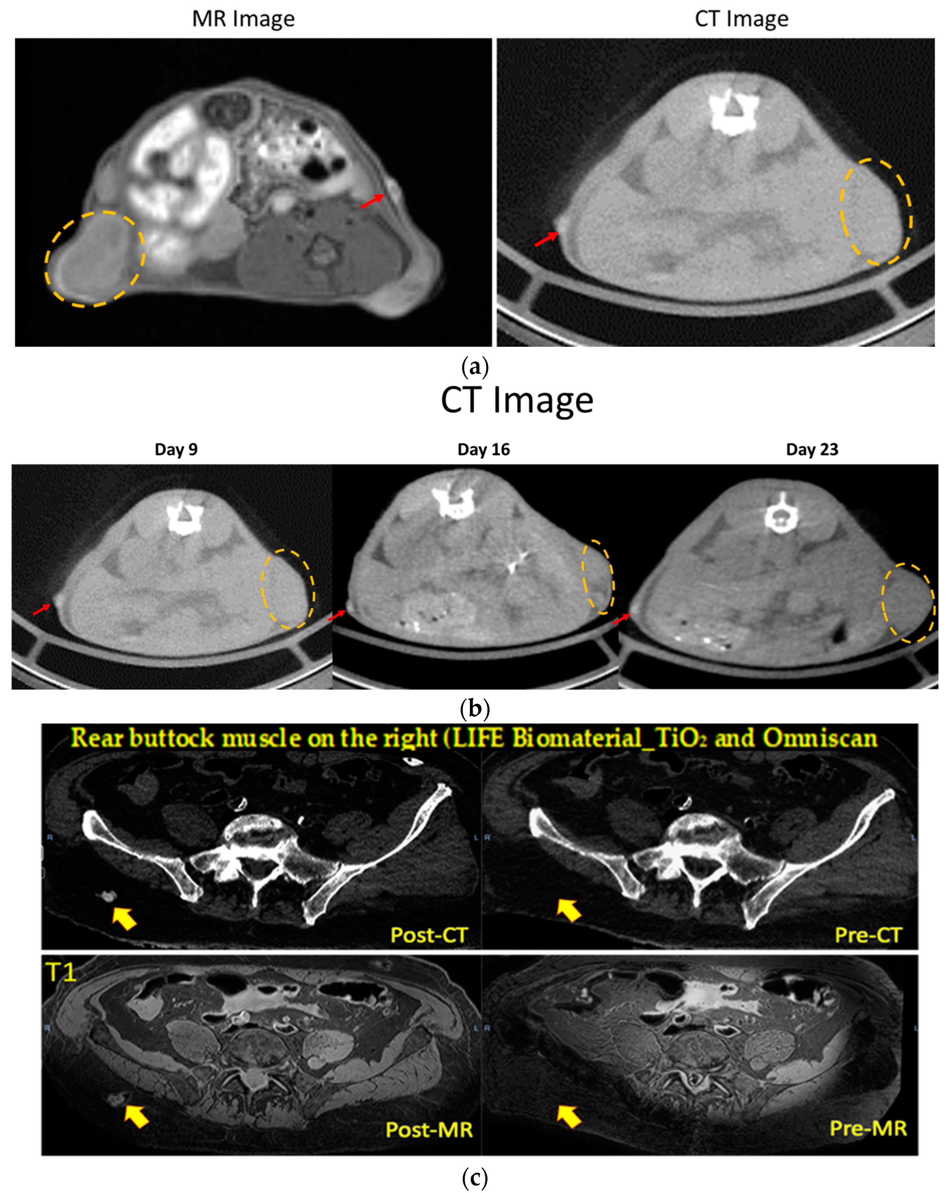 Cancers 16 01212 g003