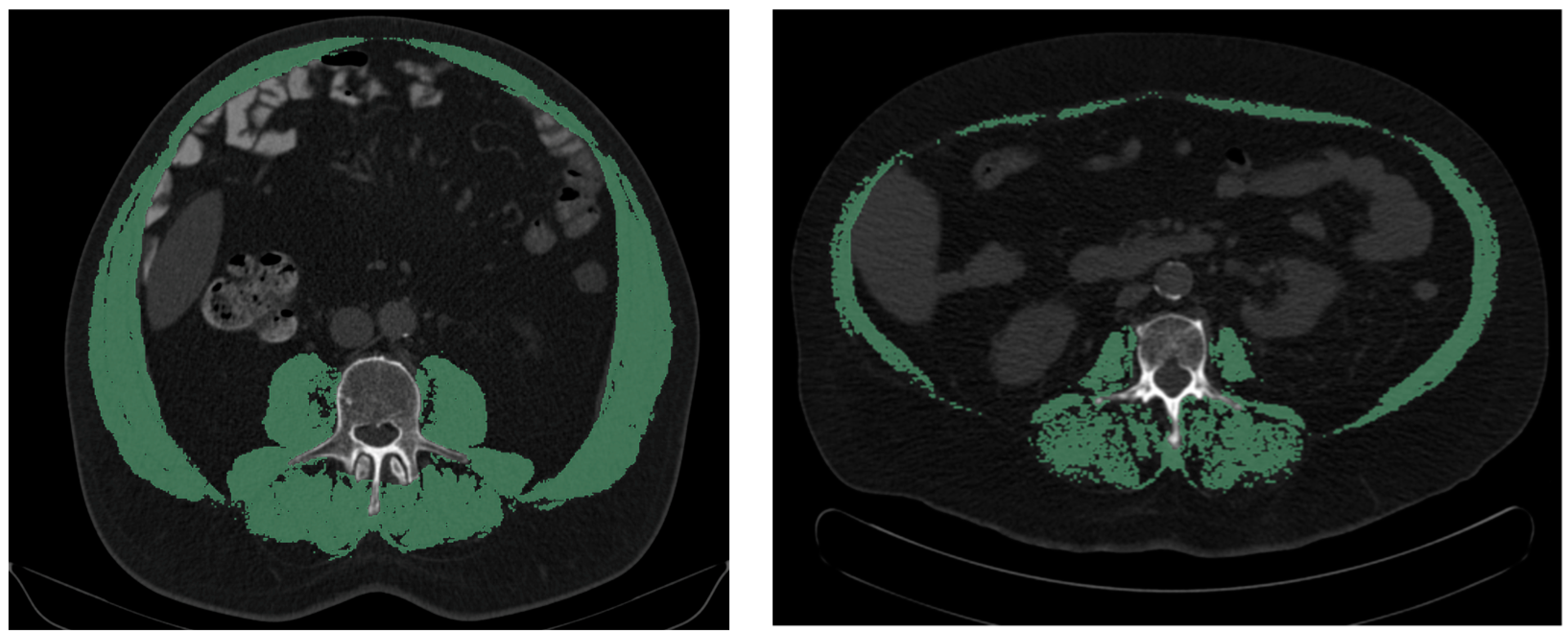 Cancers 16 01232 g001