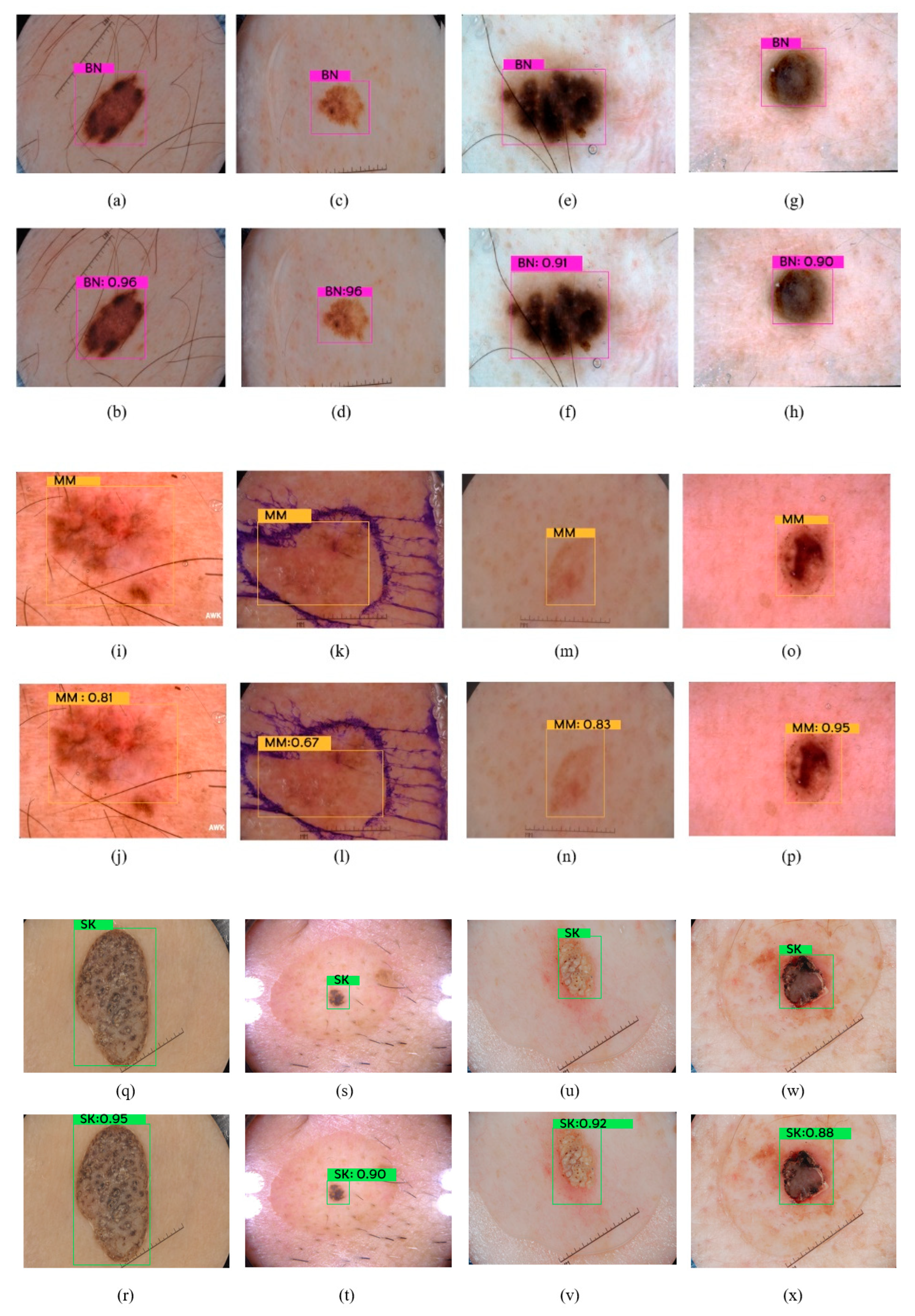 Cancers 16 01246 g009