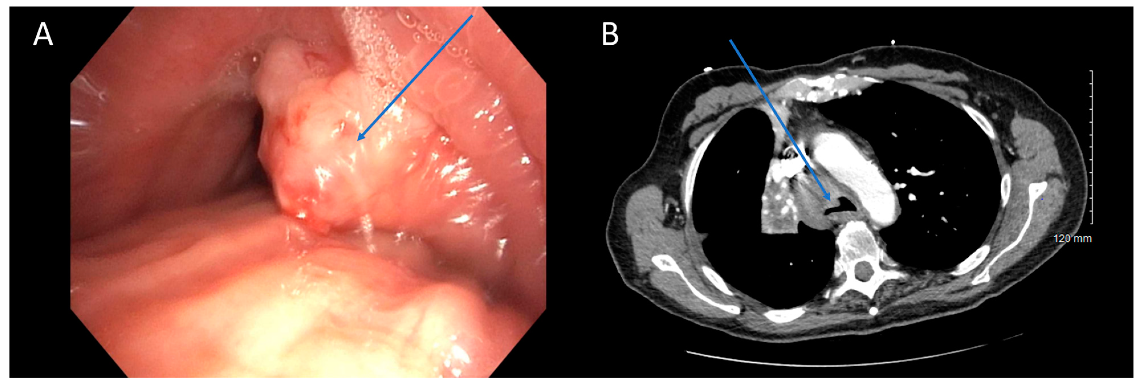 Cancers 16 01258 g001