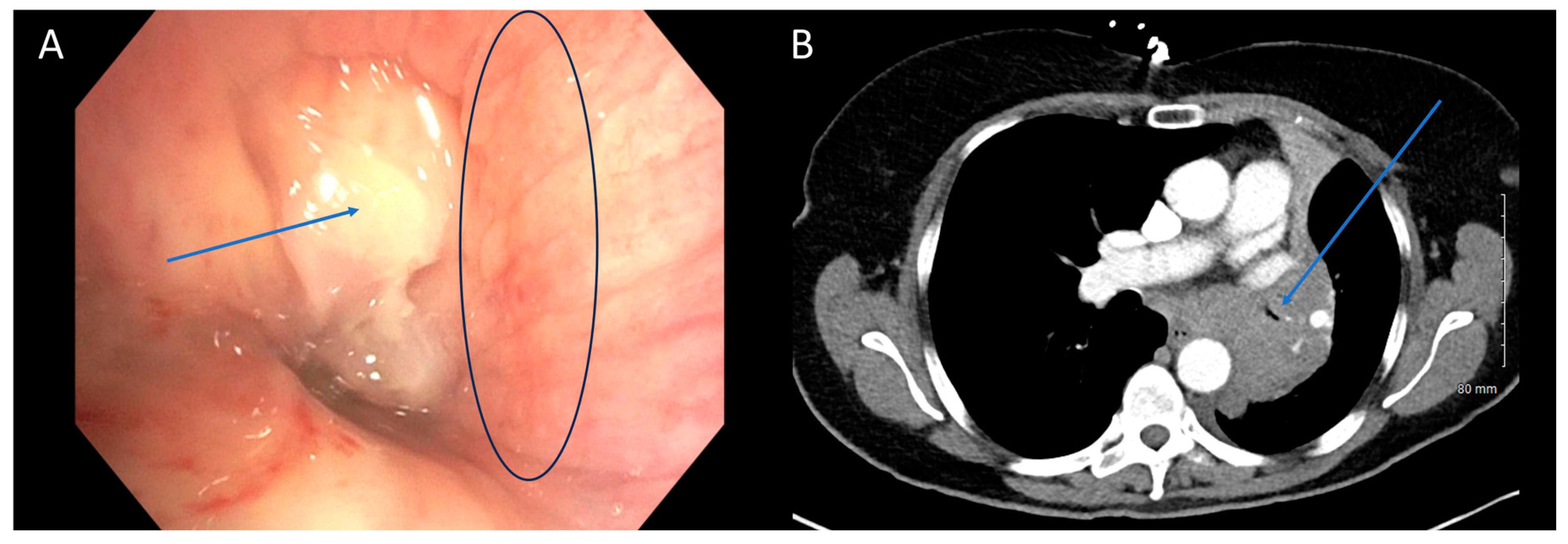 Cancers 16 01258 g002