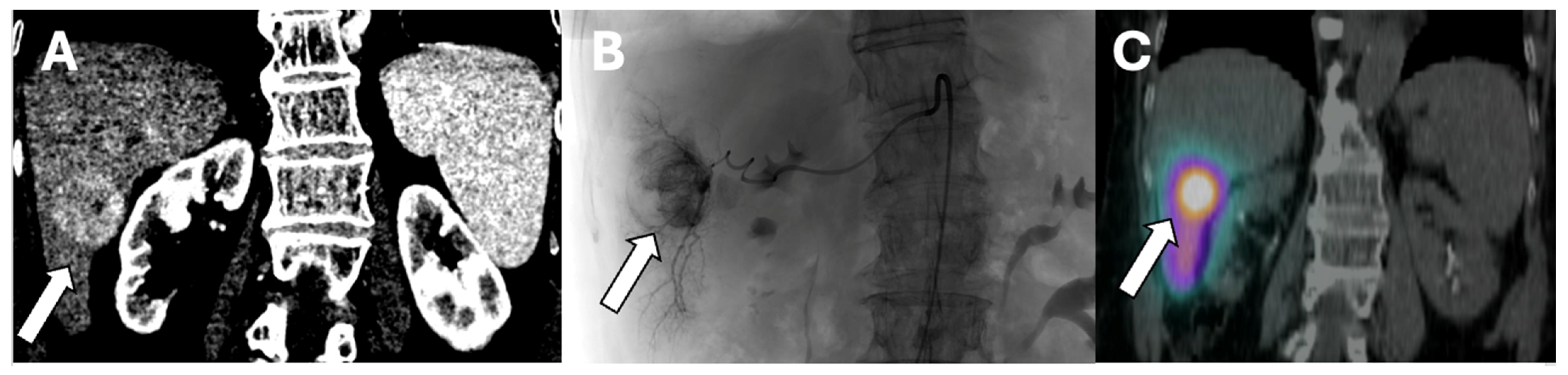 Cancers 16 01271 g001